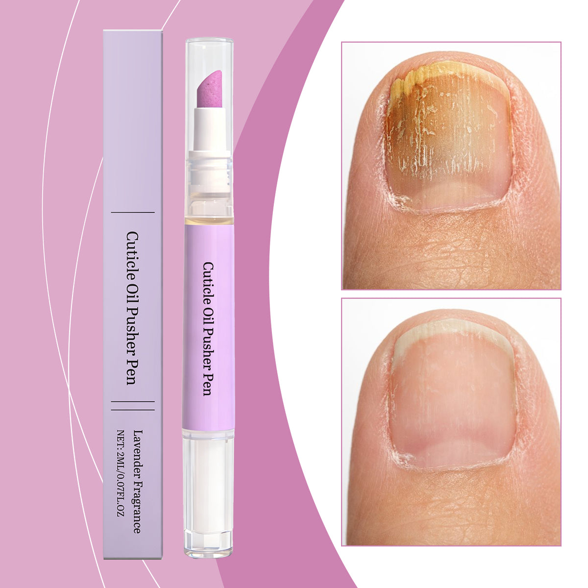 Nail Cuticle Repair Oil Pen