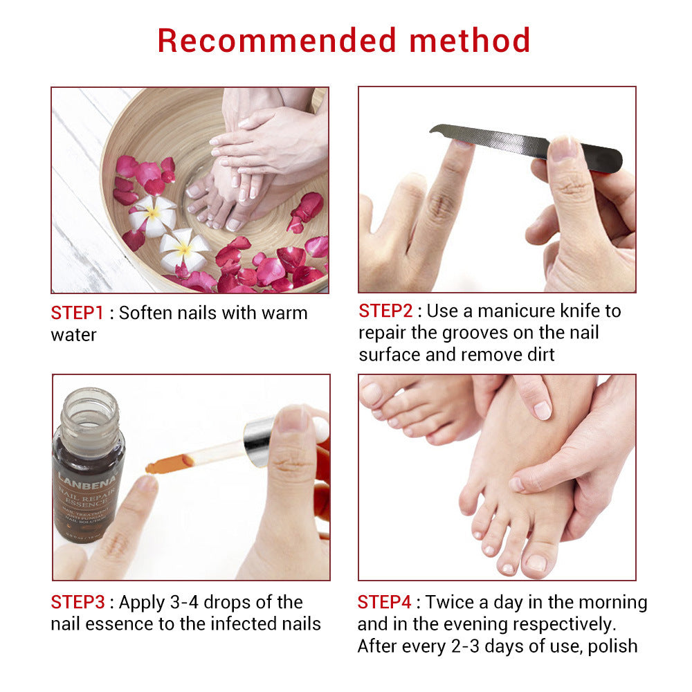 Nail With Small File 12ml