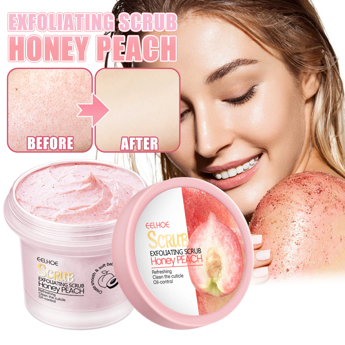 Body Scrub Exfoliant for Keratosis Pilaris & Soft Skin – 100g