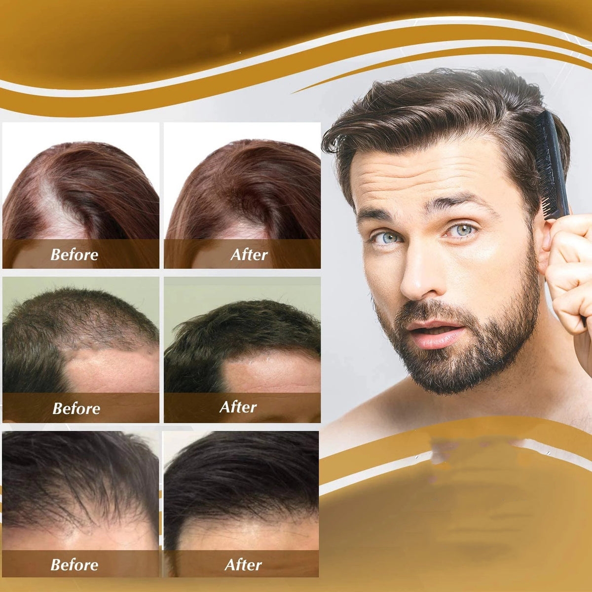 Anti Hair Loss Serum Essence Liquid 20ml