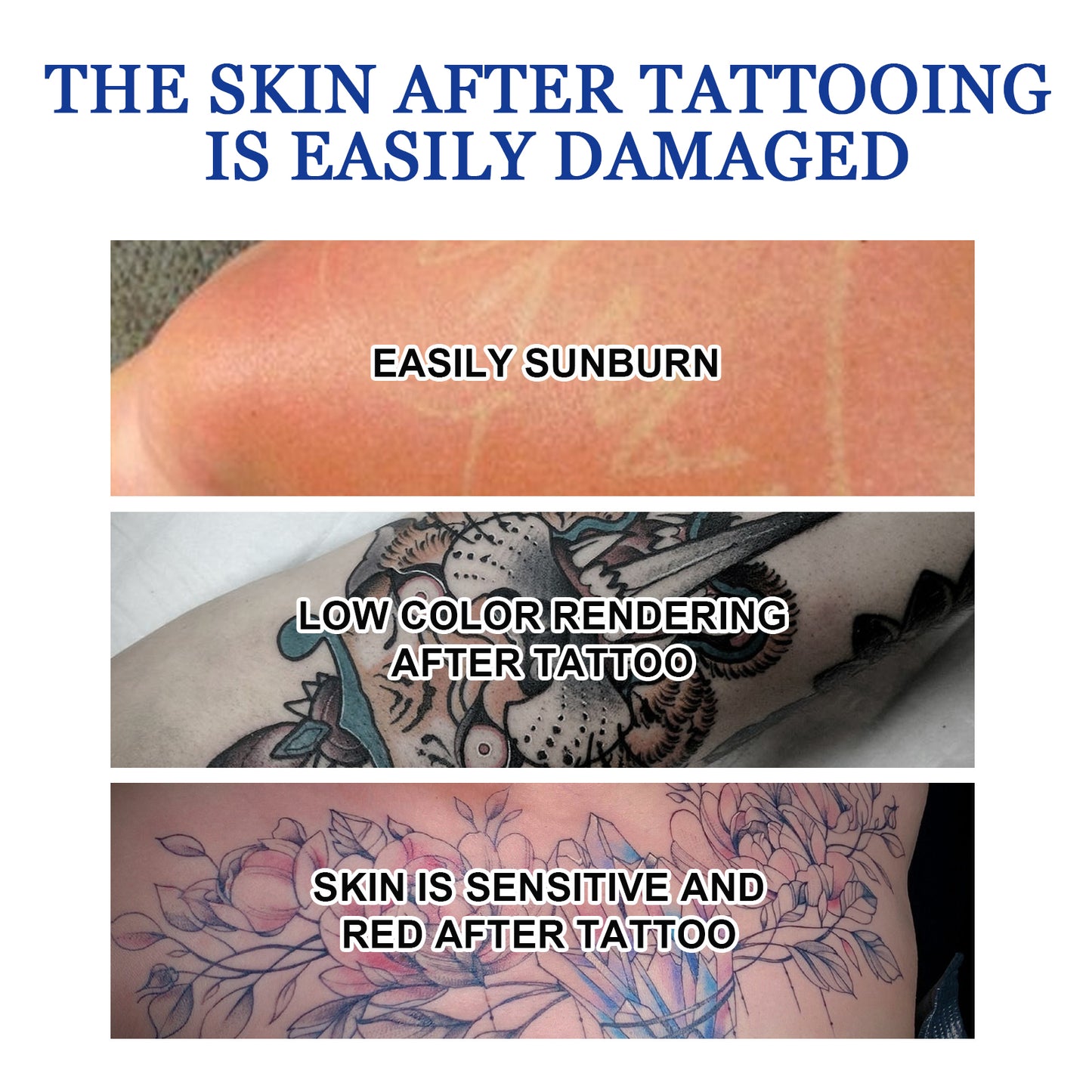 Tattoo Dissolving Gel - Skin Repair & Tattoo Brightening Cream