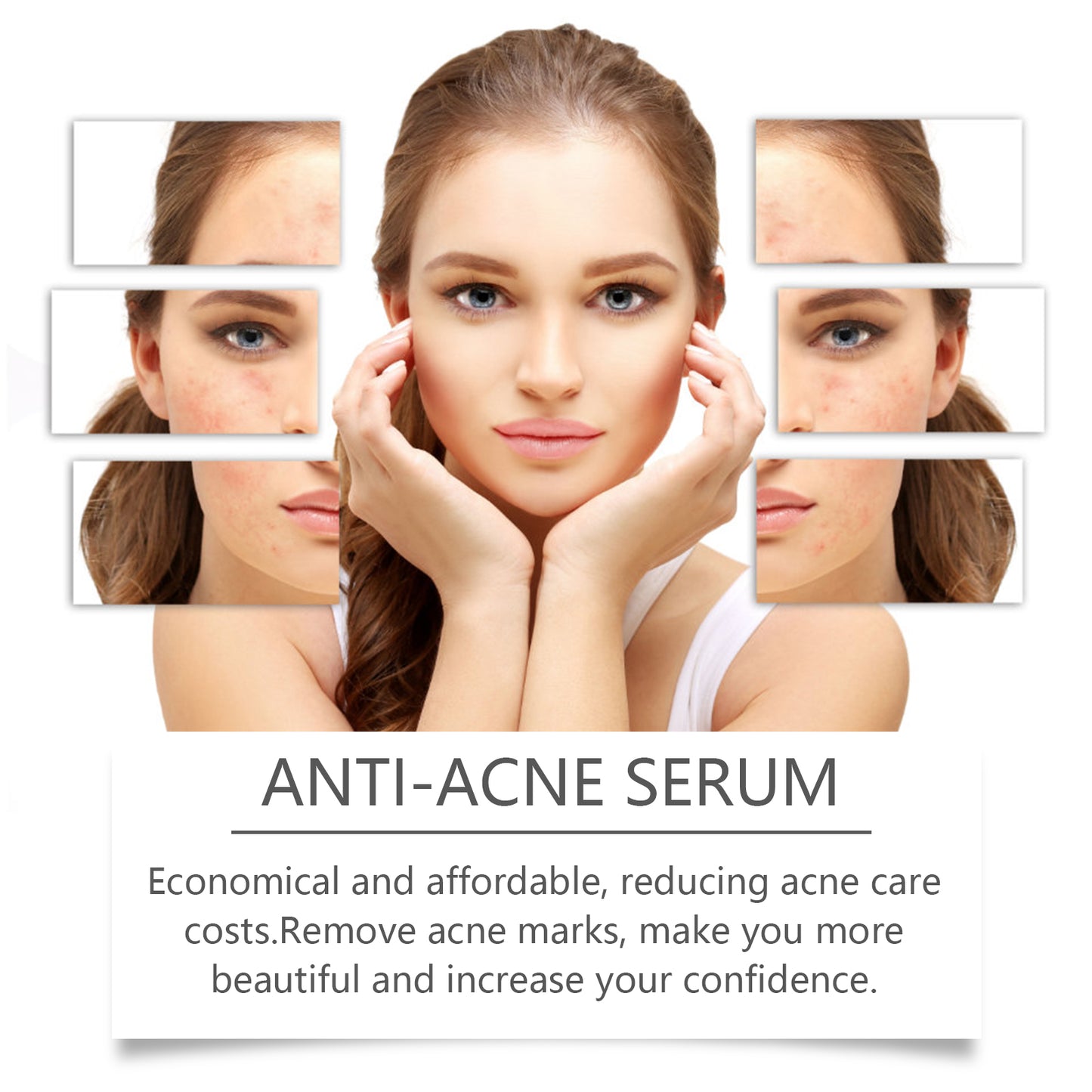 Nicotinamide Anti-Acne Serum - Moisturizing & Brightening Facial Essence