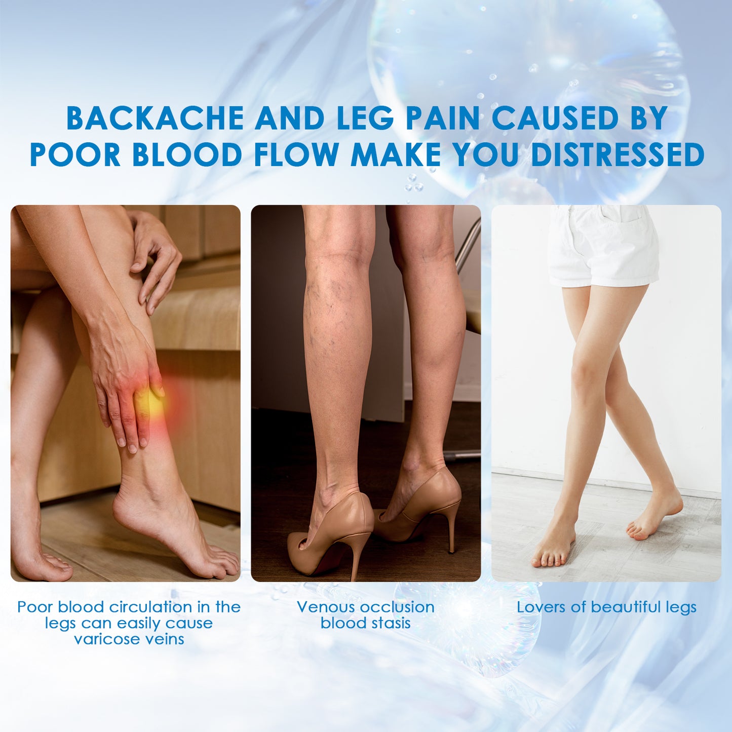 Herbal Varicose Vein Relief Spray - 30ml Leg Care & Circulation Support