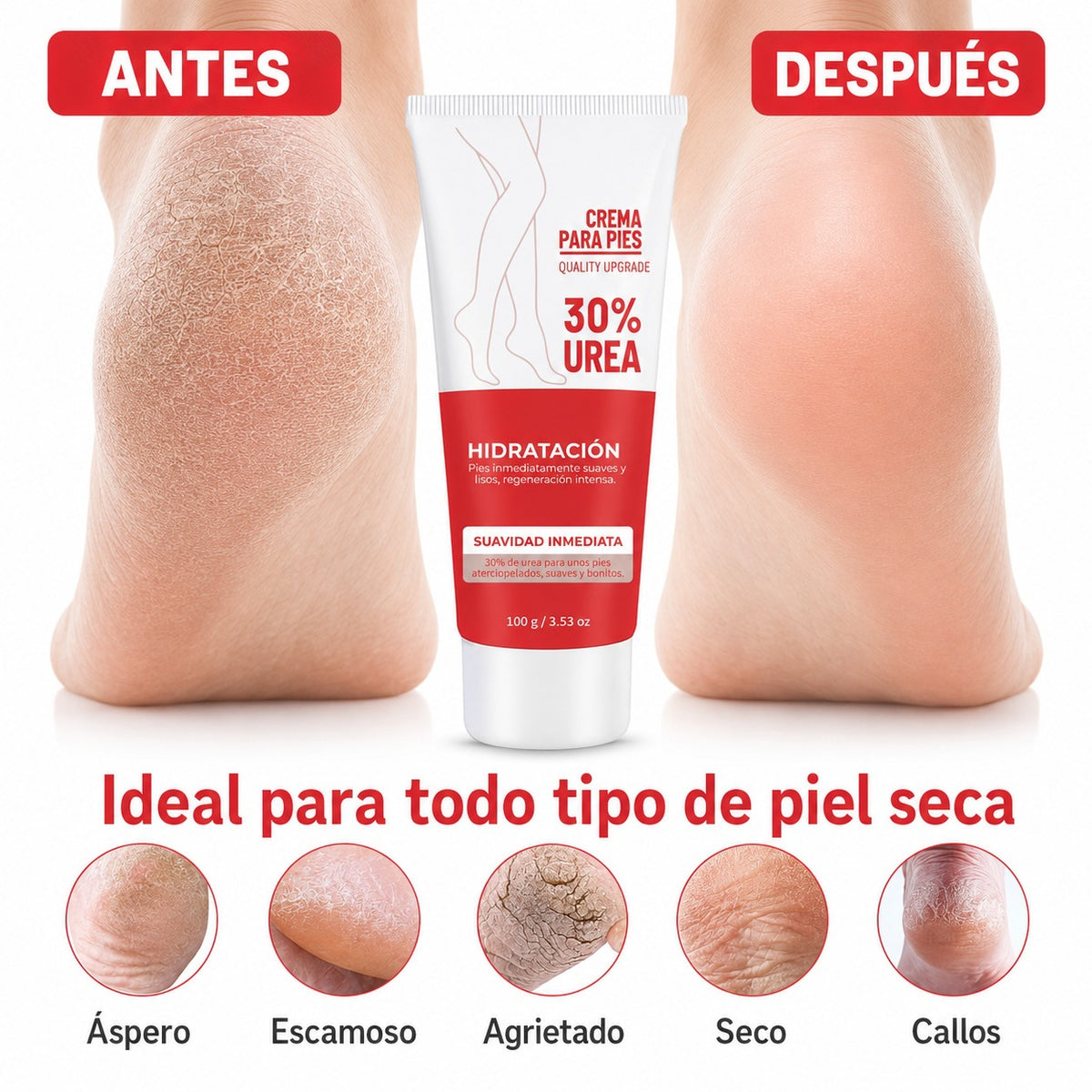 Urea Foot Cream for Cracked Heels – 50g Deep Hydration
