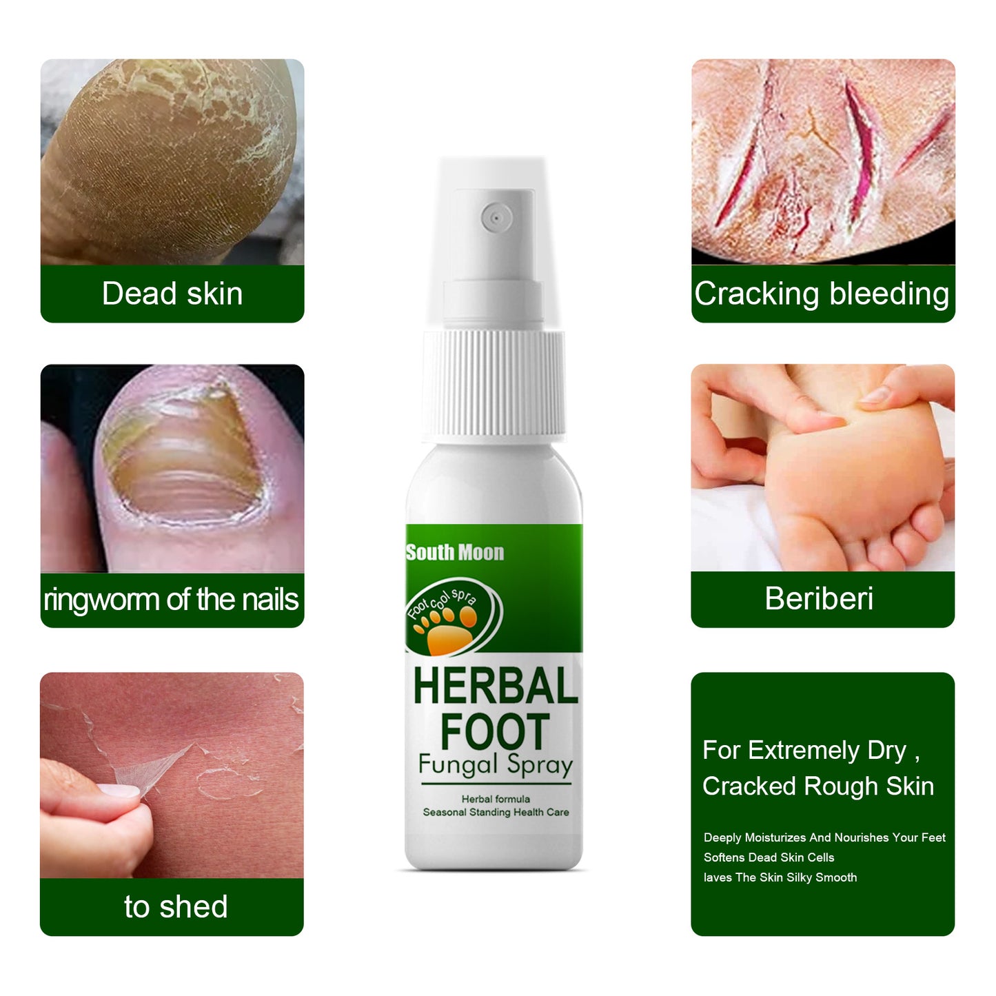 Foot Hydrating & Nourishing Spray - 30ml Moisturizing Foot Care