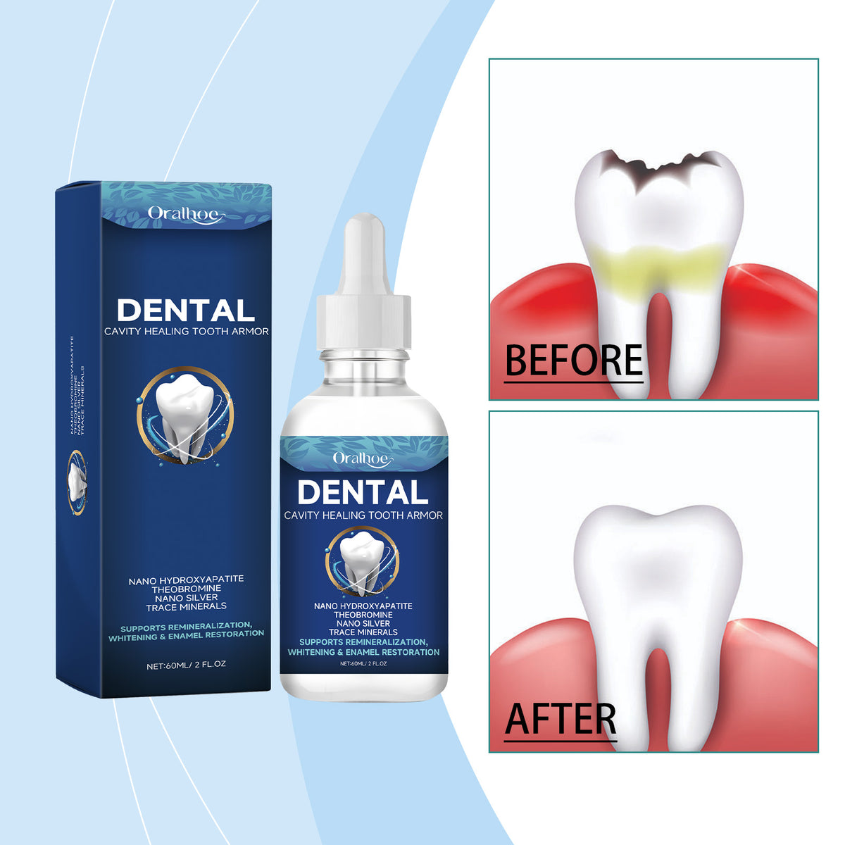Tooth Care Solution - 60ml Oral Hygiene Liquid for Dental Care