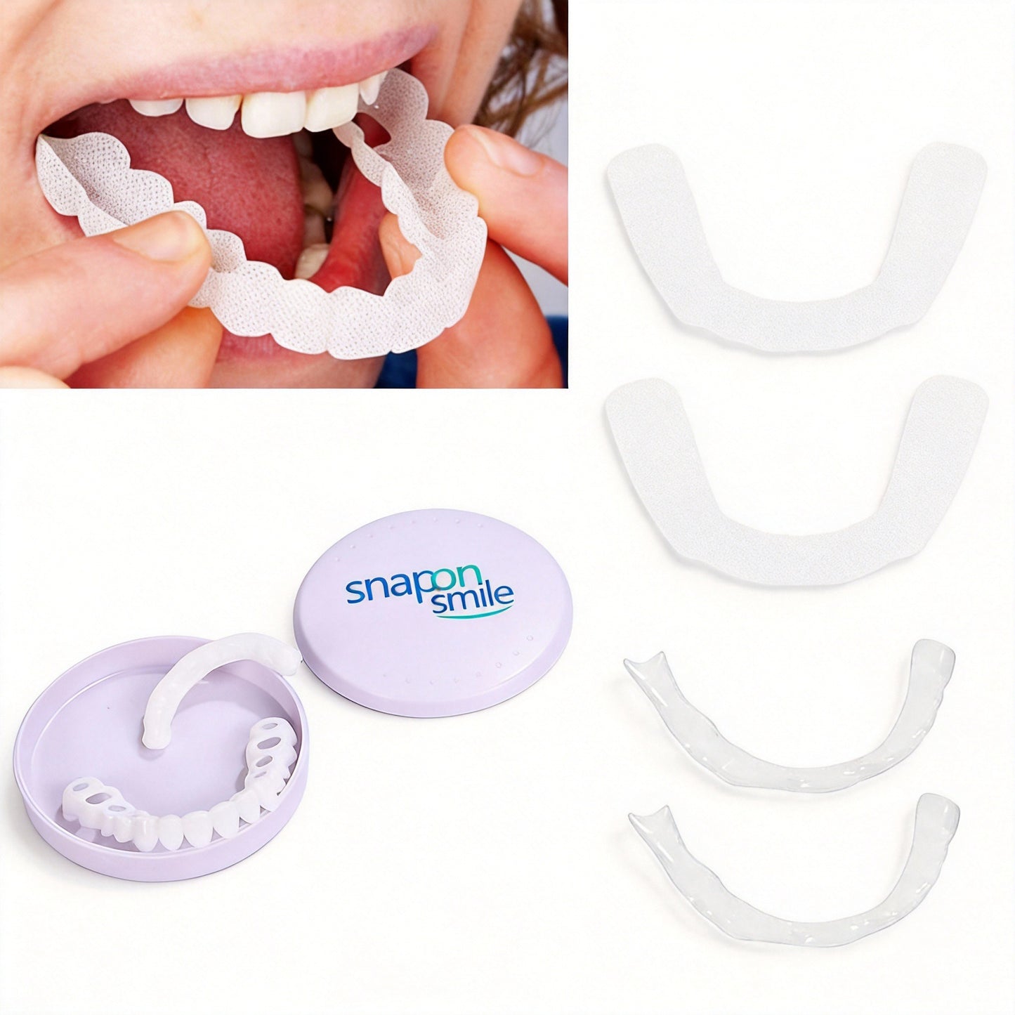 Comfortable Silicone Cosmetic Veneers for Dentures - White