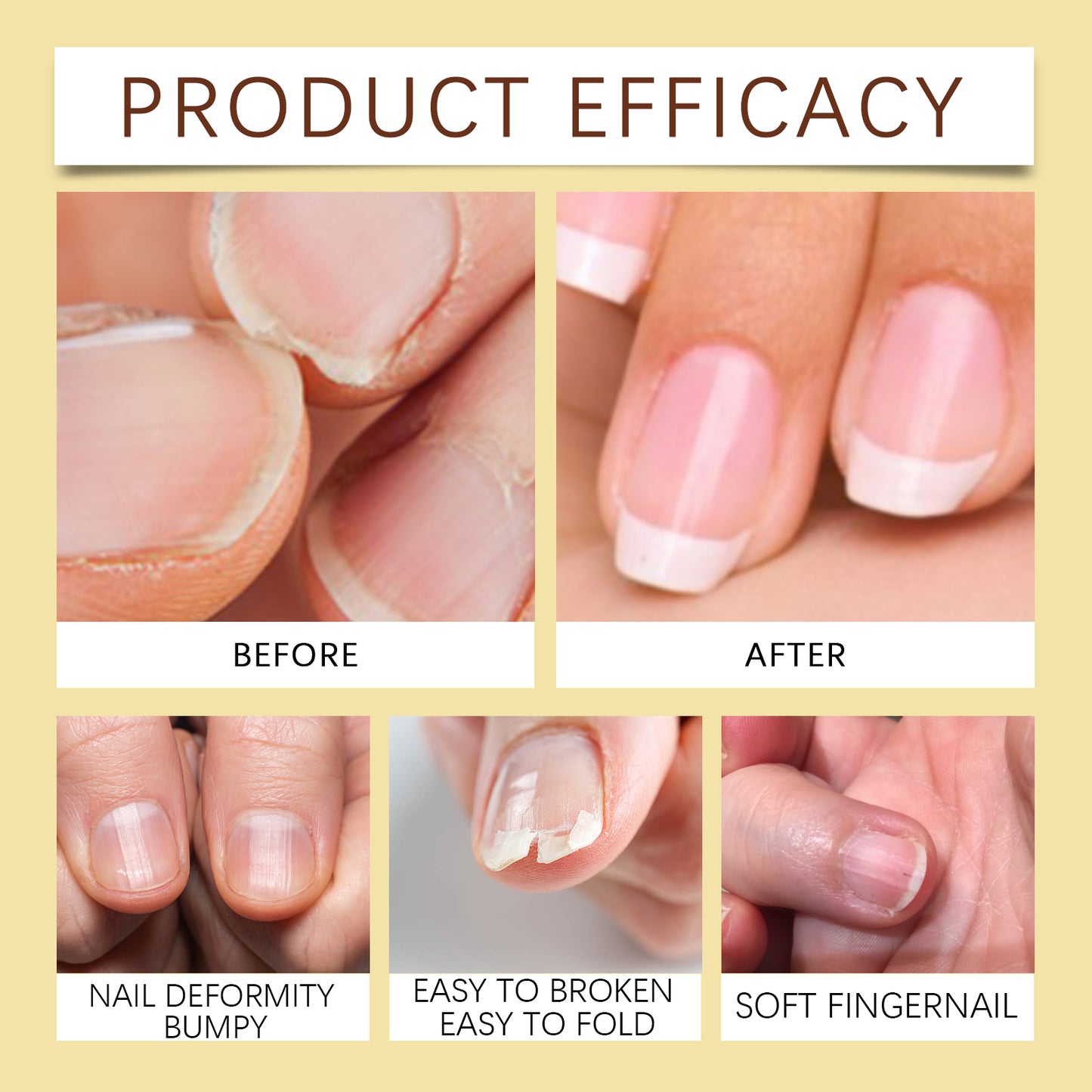 Jojoba Nail Care Oil - Nourishing & Strengthening Cuticle Treatment - 15ml