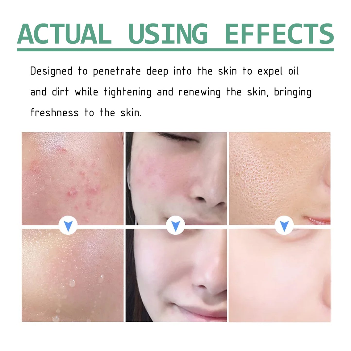 Green Tea Deep Cleansing Mud Mask - Blackhead Removing & Hydrating Facial Care