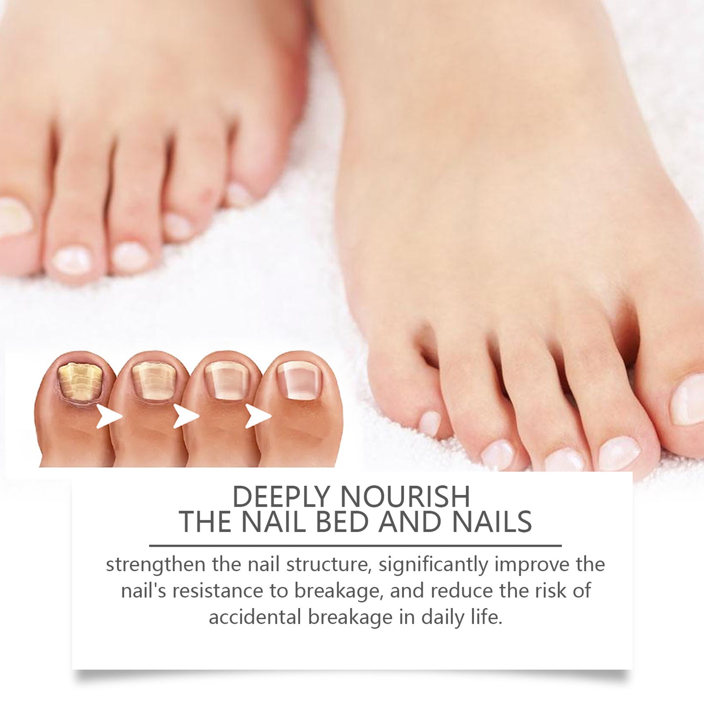 Bee Venom Nail Repair Solution - Moisturizing Hand & Foot Nail Treatment