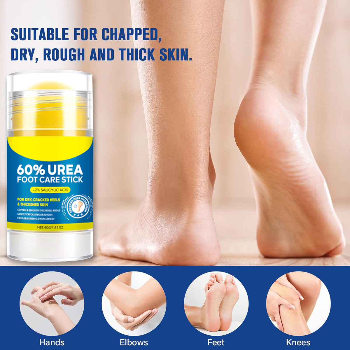 Urea Body Lotion - Hydrating Moisturizer for Dry Skin