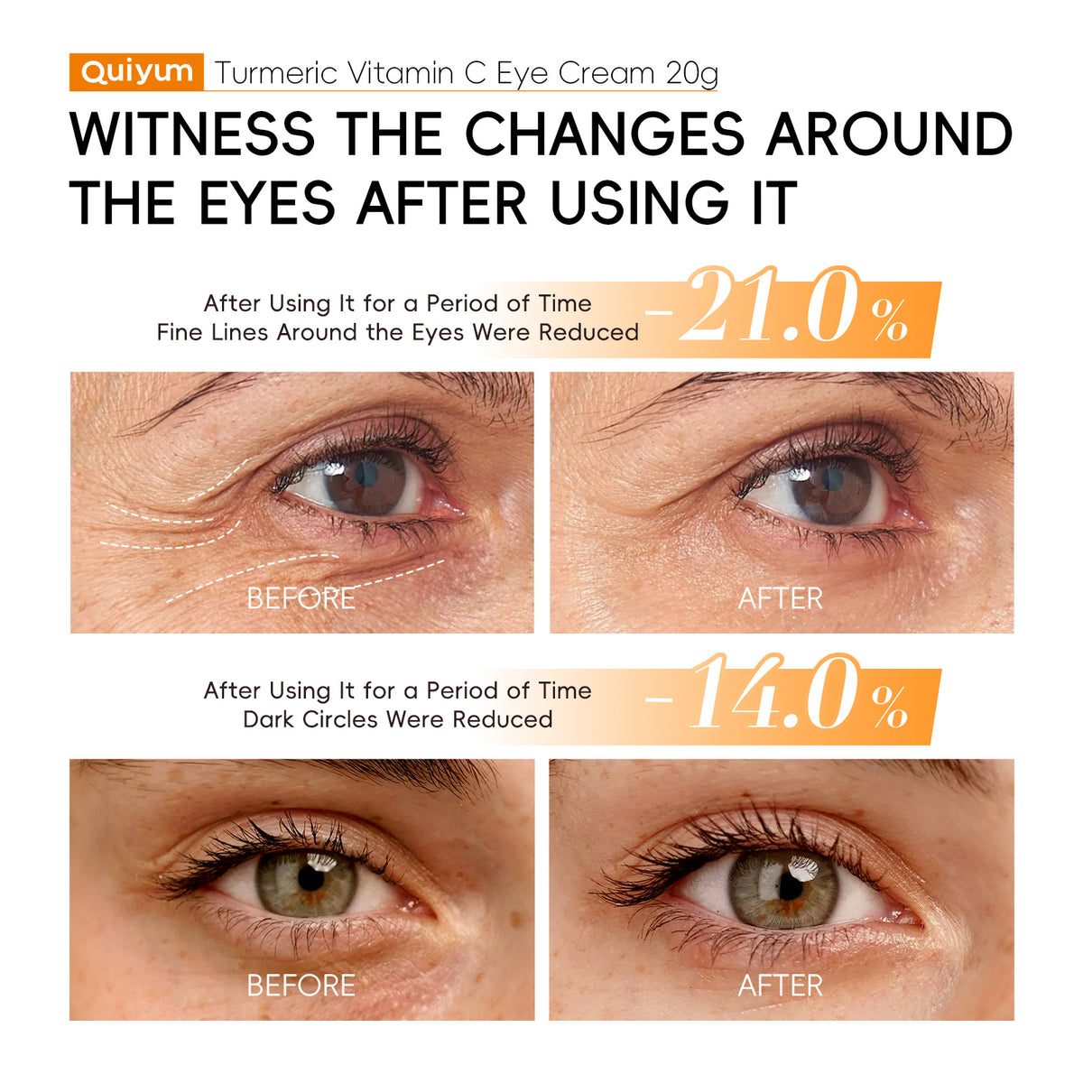 Hydrating Eye Cream for Dark Circles and Puffiness - 15g Moisturizer