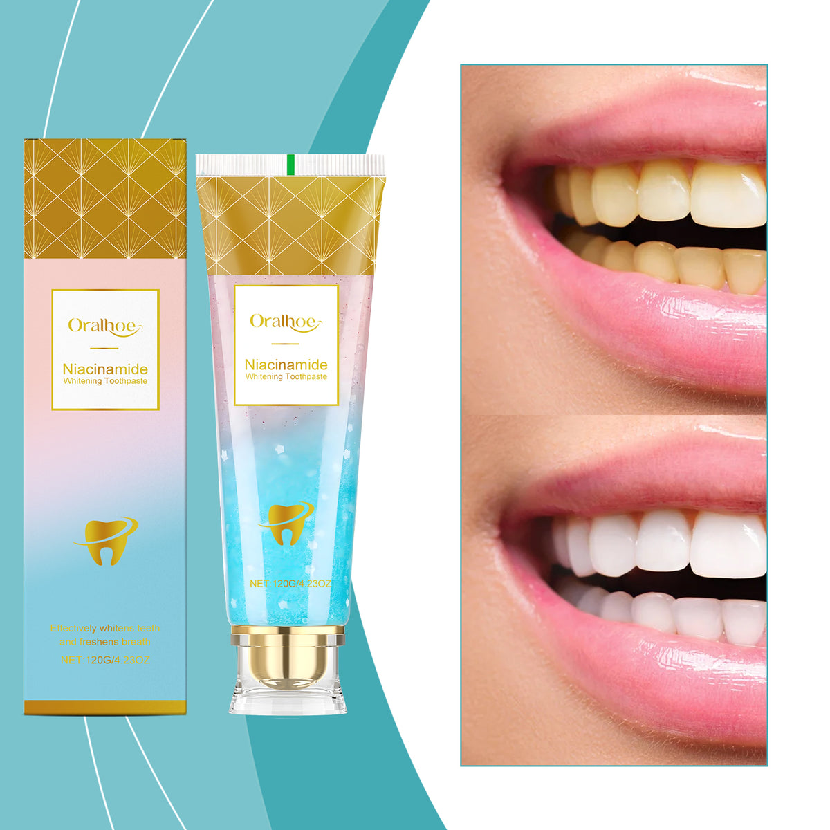 Niacinamide Whitening Toothpaste 120g - Brightening & Fresh Breath
