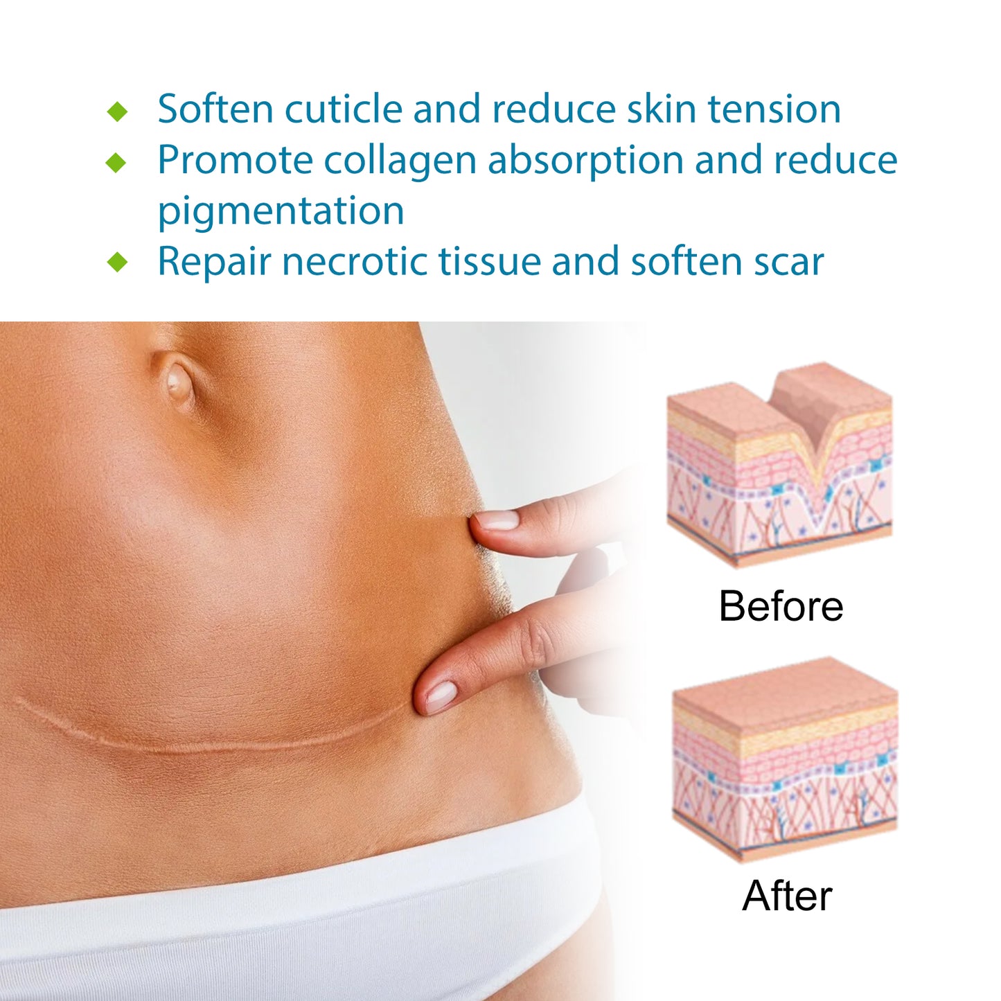 Self-Adhesive Silicone Scar Repair Sheet for Smooth Skin - Cut to Size