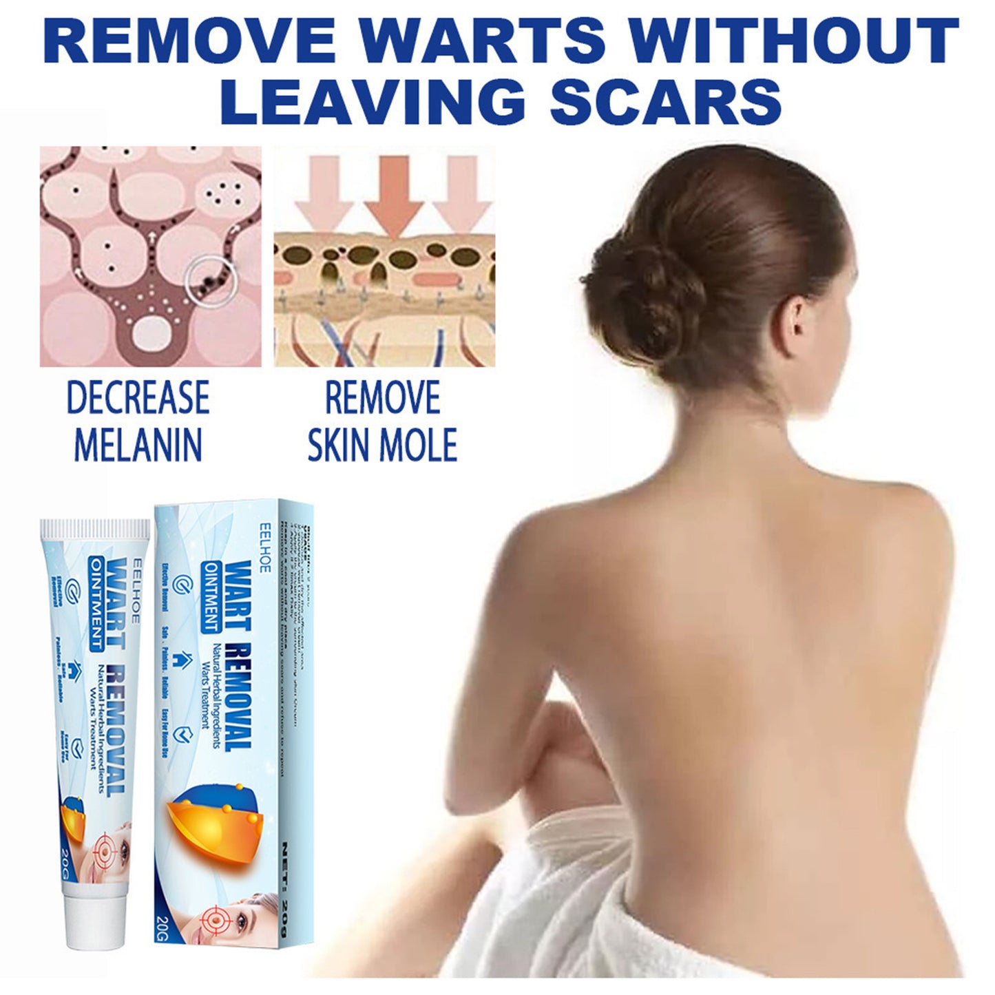 Skin Blemish and Wart Removal Cream - Natural Herbal Formula