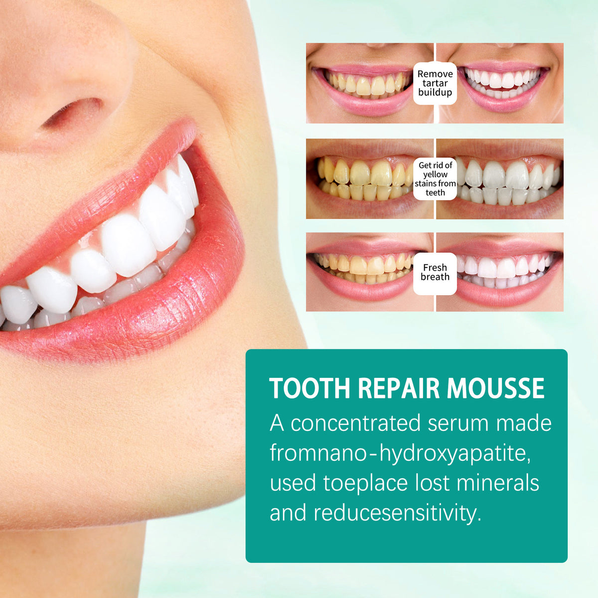 Whitening Toothpaste for Stain Removal & Gum Care - 50g