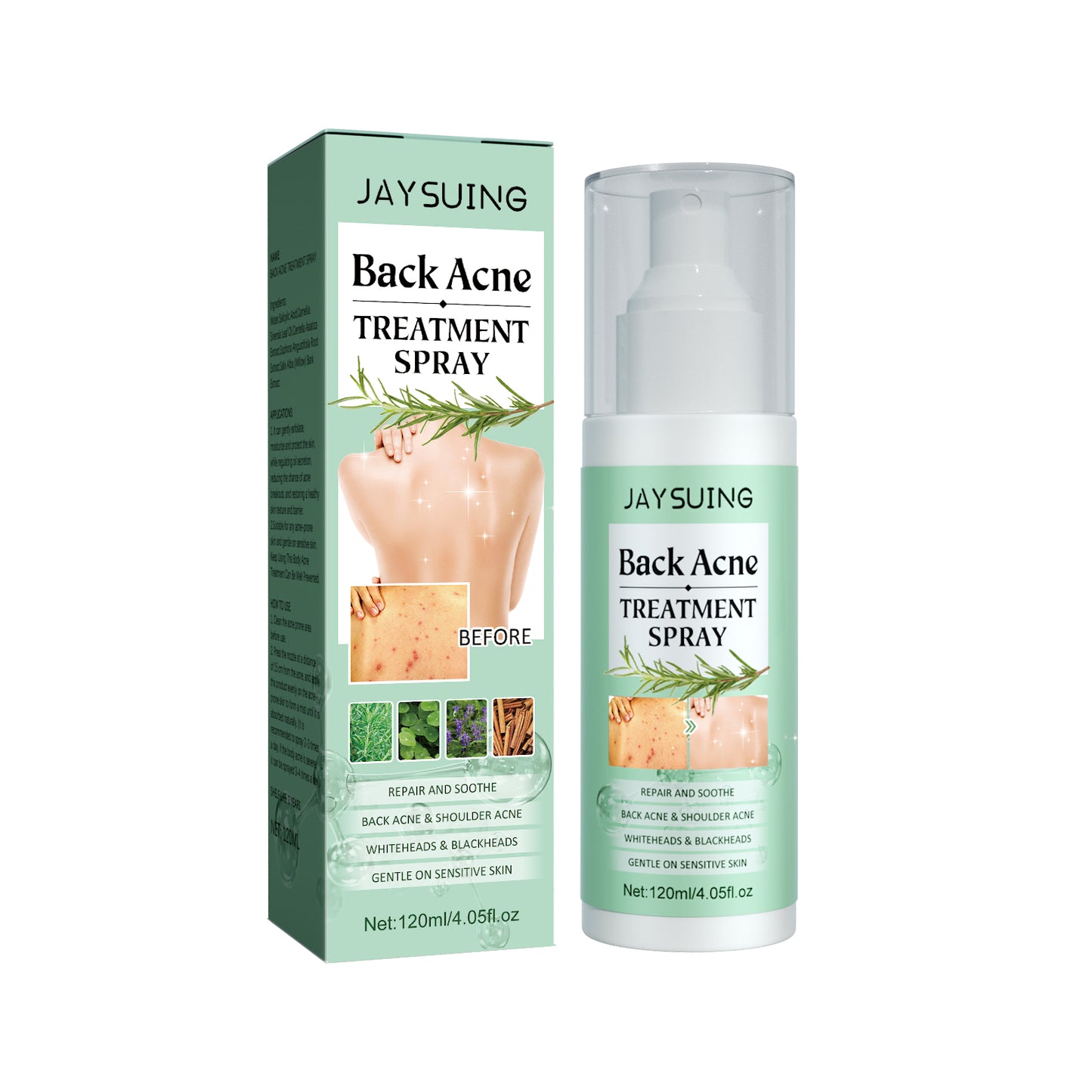 Back Acne Repair Treatment Spray - Salicylic Acid Body Acne Clearing Mist