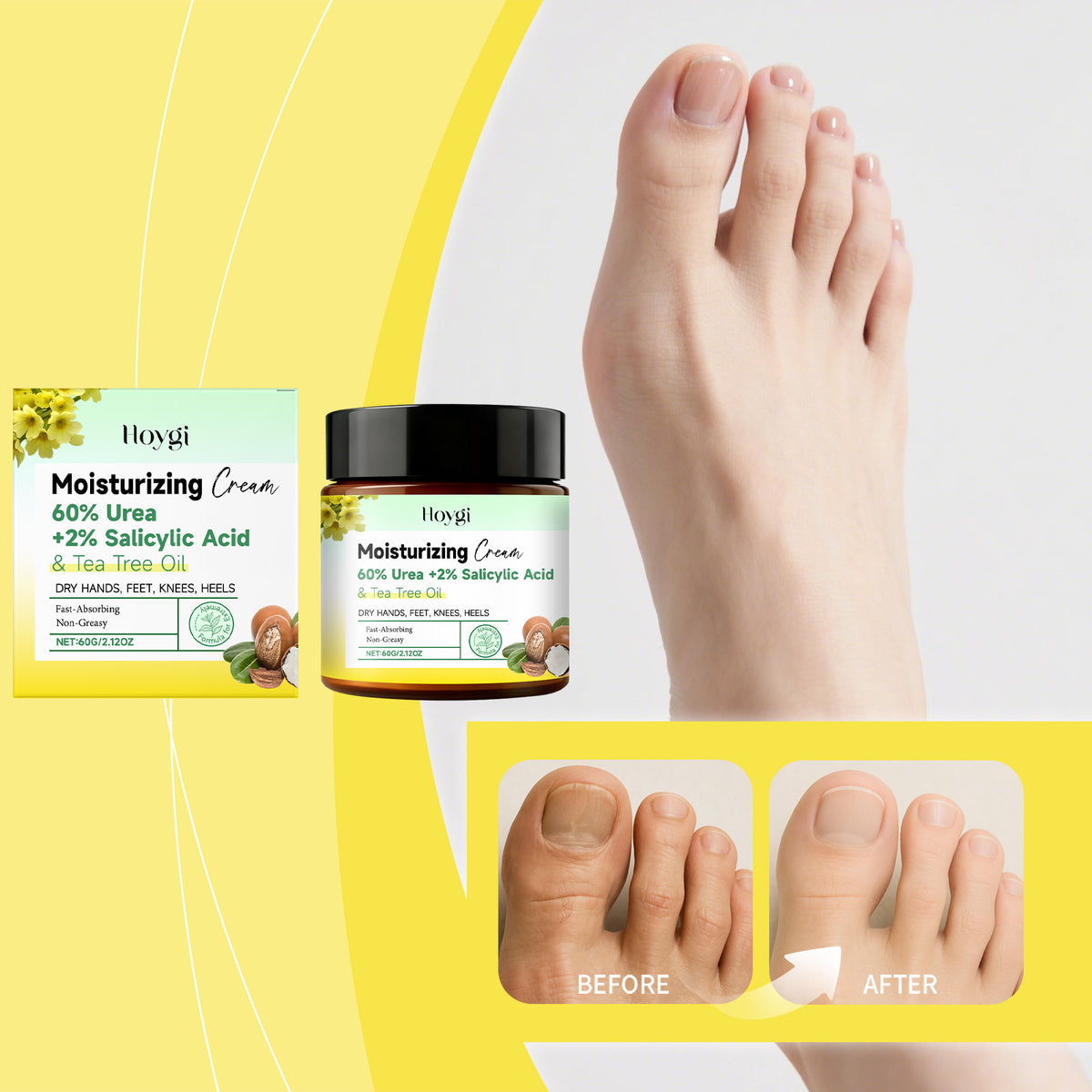Urea Hand & Foot Moisturizing Cream - 60g