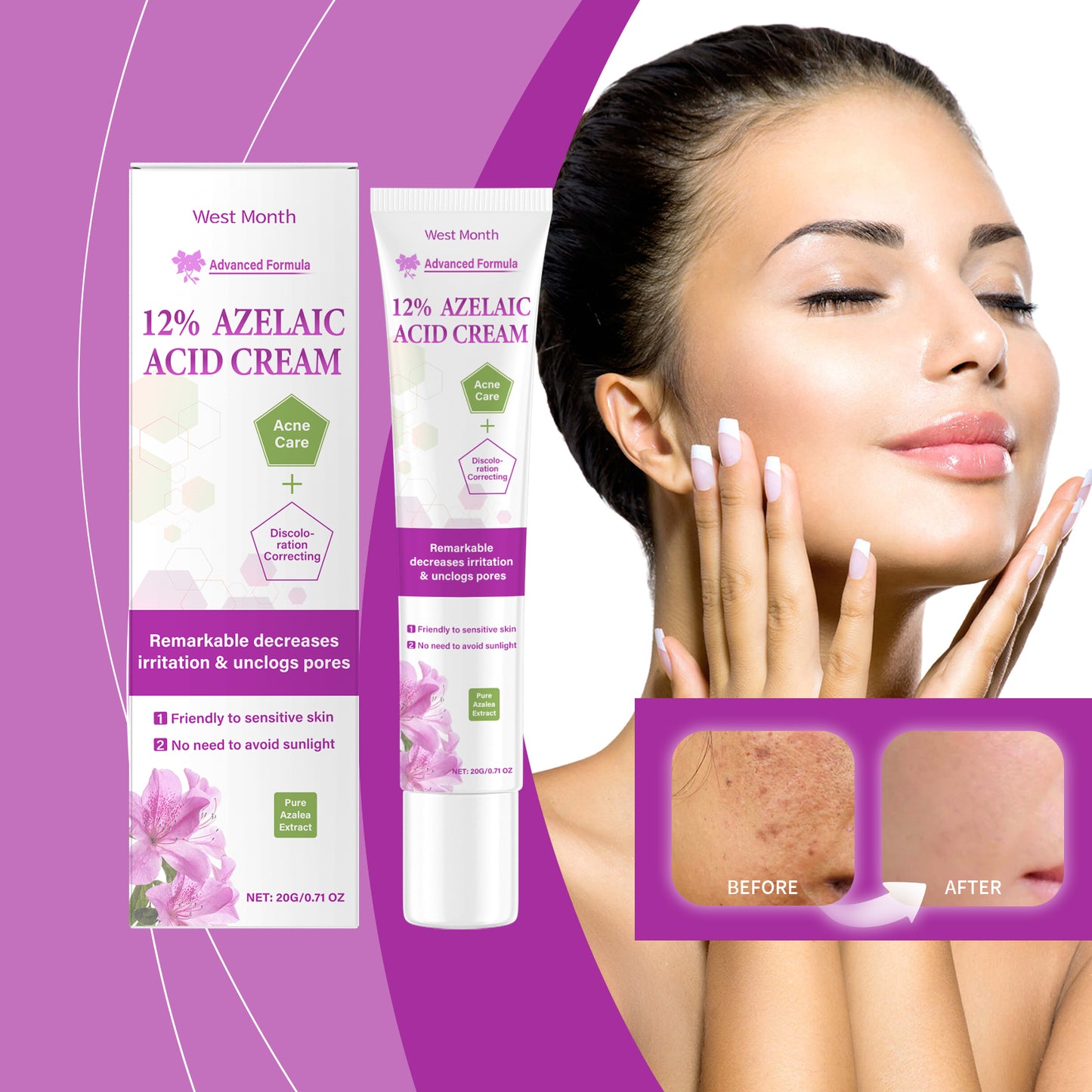 Azelaic Acid Acne Treatment Cream with Salicylic Acid & Niacinamide