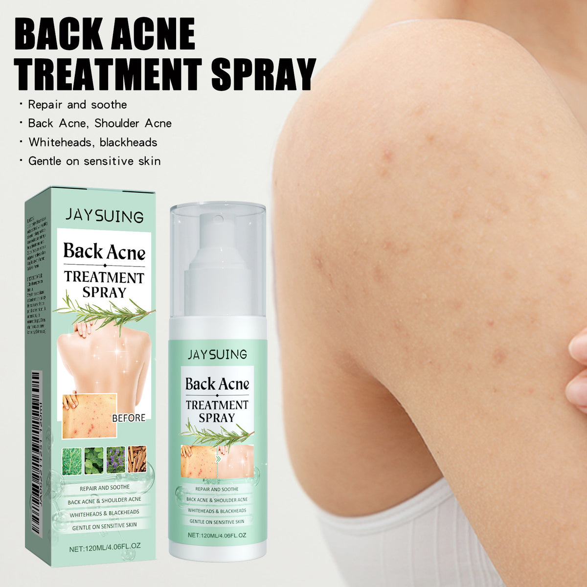 Back Acne Cleansing Spray - 120ml