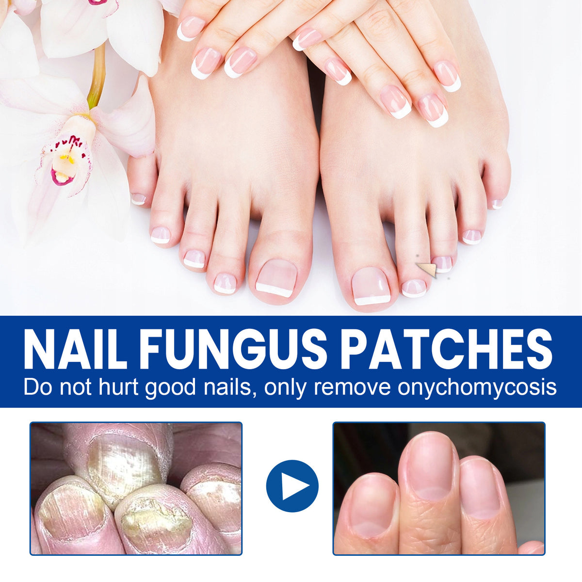 Nail Repair Adhesive Bandages Pack - 32 Patches for Nail Care