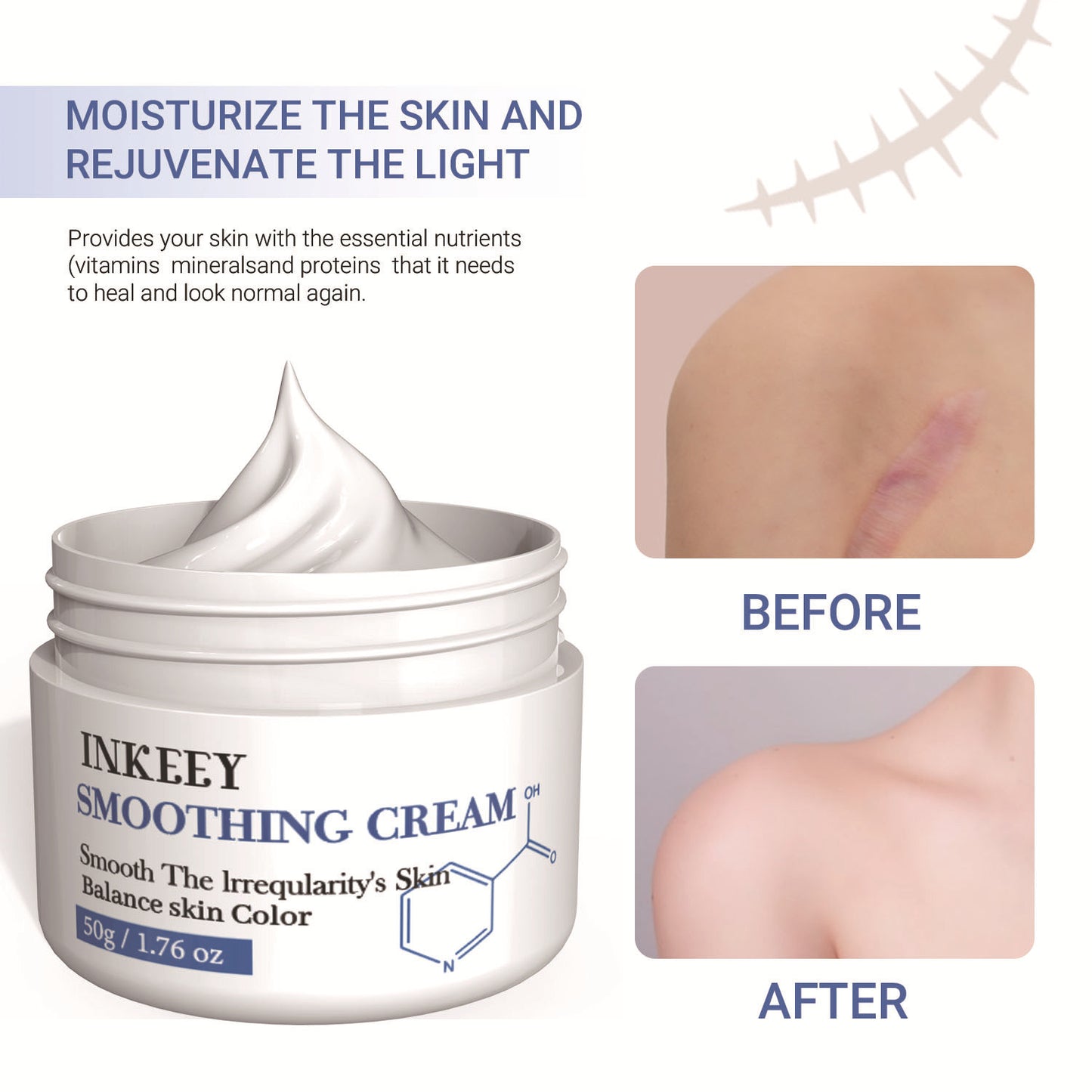 Skin Recovery Cream 50g for Scar & Skin Repair - Universal Face & Body Care