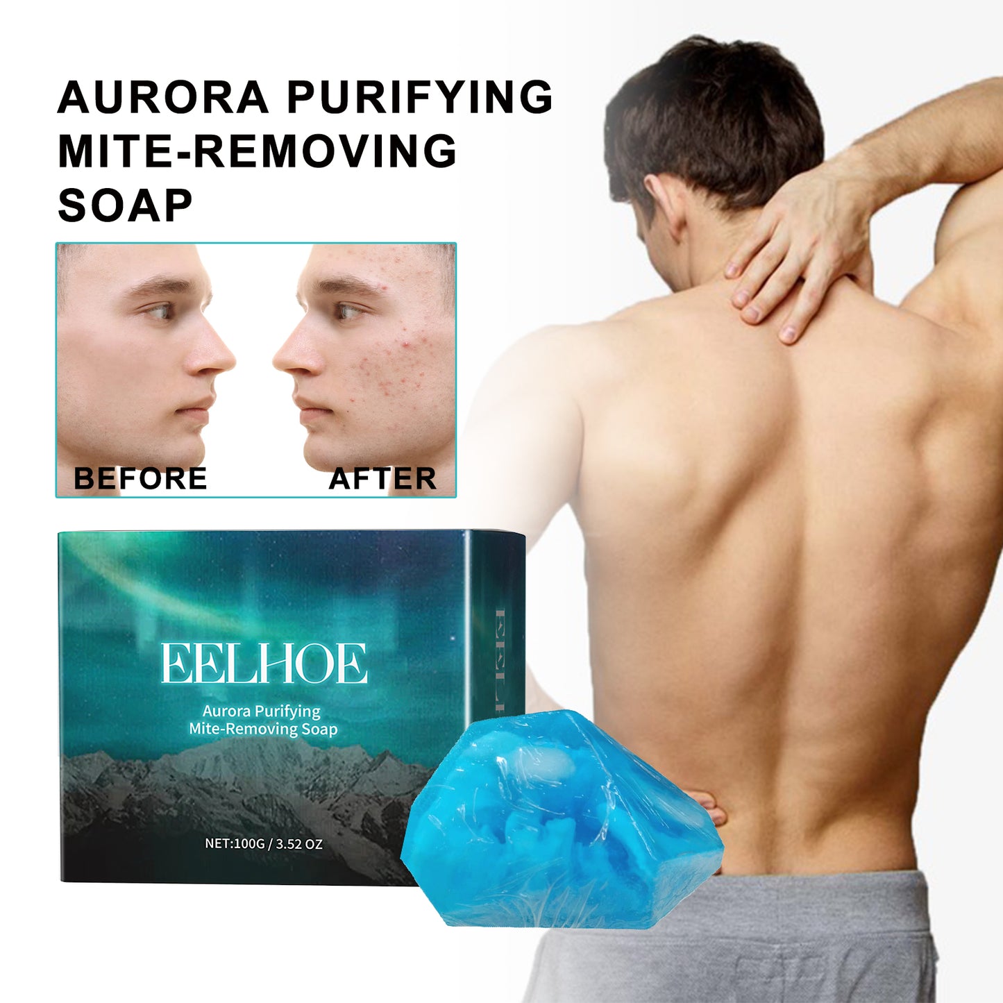 Aurora Purifying Mite-Removing Soap - Deep Cleansing Tea Tree Oil Bar
