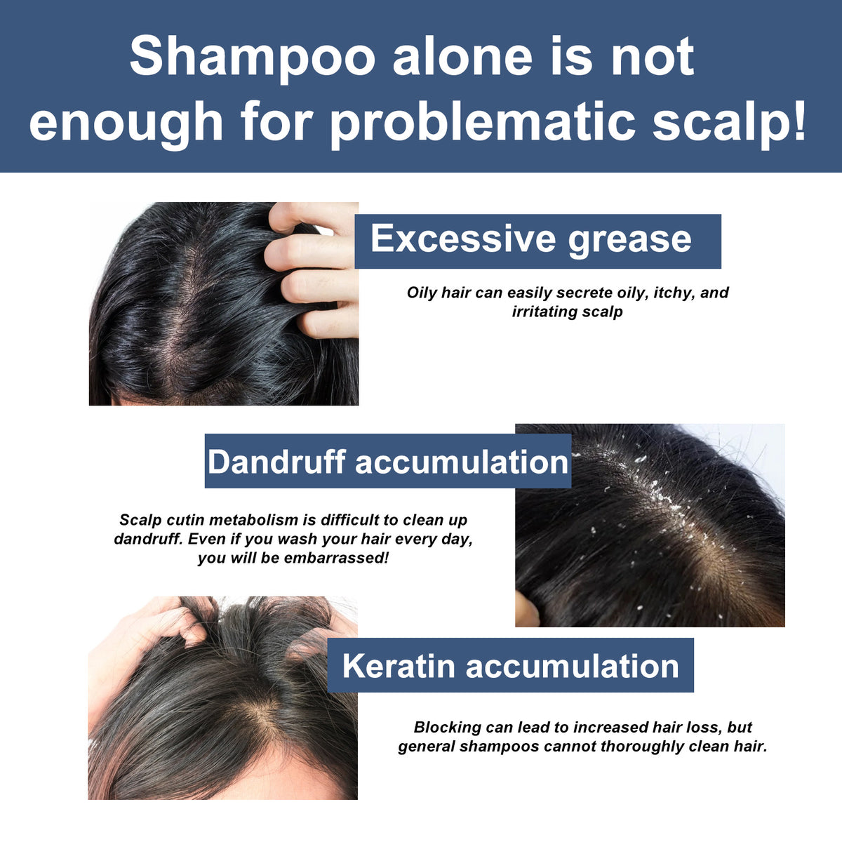 Scalp Exfoliating Facial Scrub Oil Control Fluffy Deep Cleansing Care