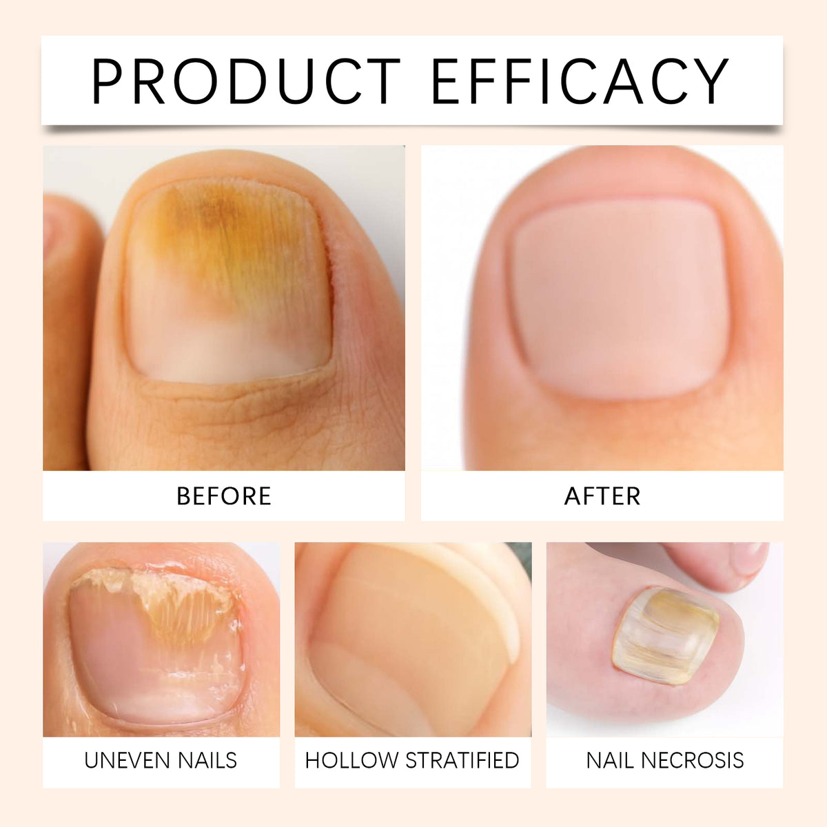Nail Nourishing Spray 20ml - Strengthens & Repairs Nails