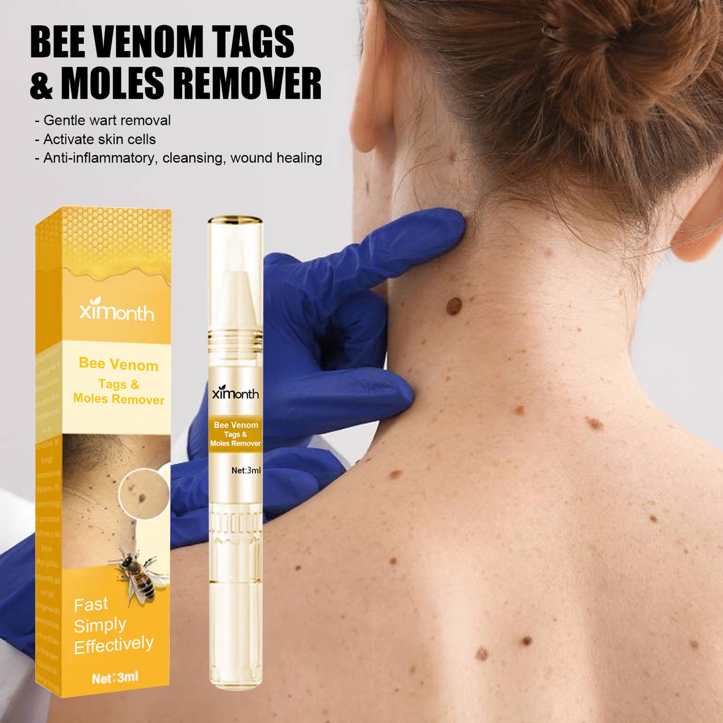 Liquid Skin Wart Removal Pen 3ML - Gentle Mole & Skin Mark Remover