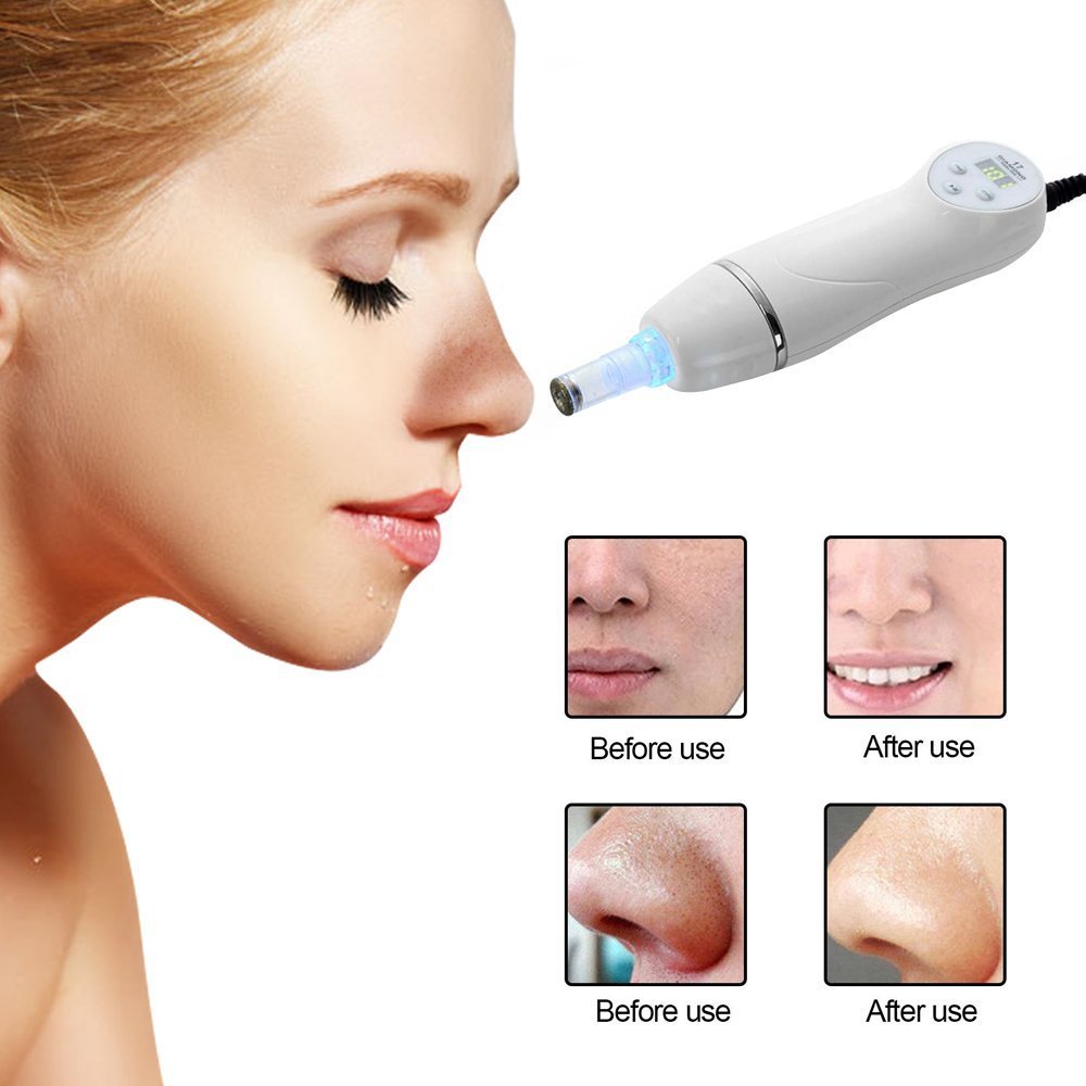 Electric Blackhead Remover for Pore Cleansing - Rechargeable Facial Skin Care Tool