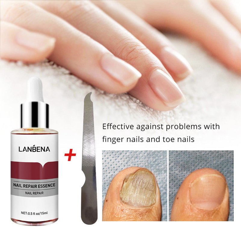 Nail Repair Serum for Fungus Damage & Cracking - 15ml, Multiple Sizes