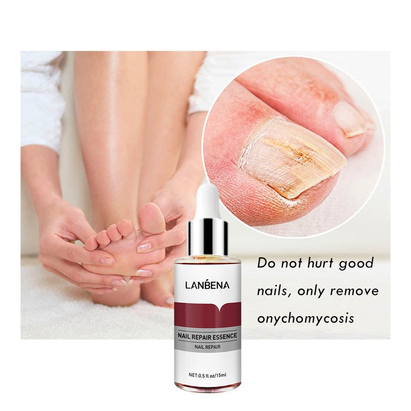 Nail Repair Serum for Fungus Damage & Cracking - 15ml, Multiple Sizes