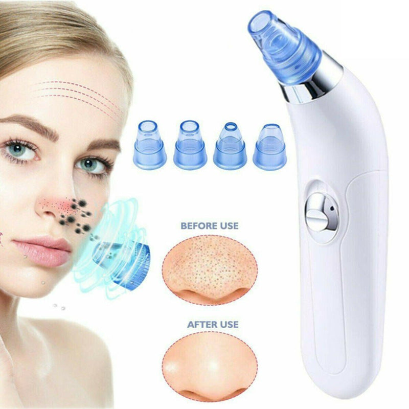 Electric Blackhead Pore Cleaner Ultrasonic Suction Facial Skin Care Tool