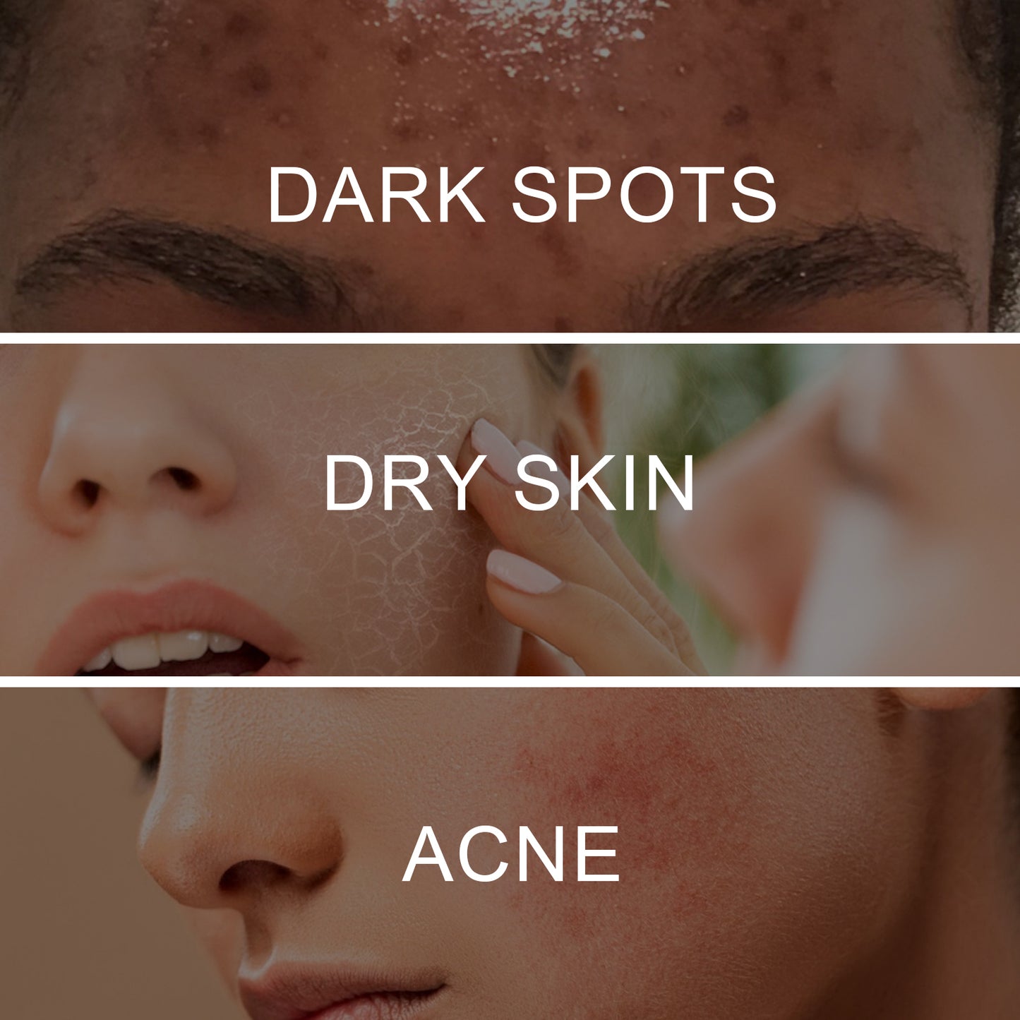 Retinol Pigment Correcting Spray - Skin Brightening & Dark Spot Treatment