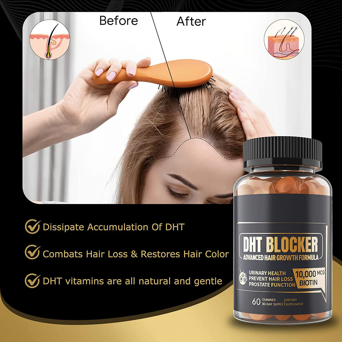 DHT Blocking Agent Soft Candy Hair Gummies 60 Capsules
