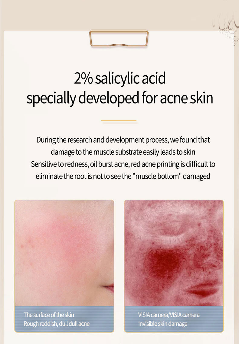 Acne Treatment Serum with Salicylate - Universal Skin Care, 15ml
