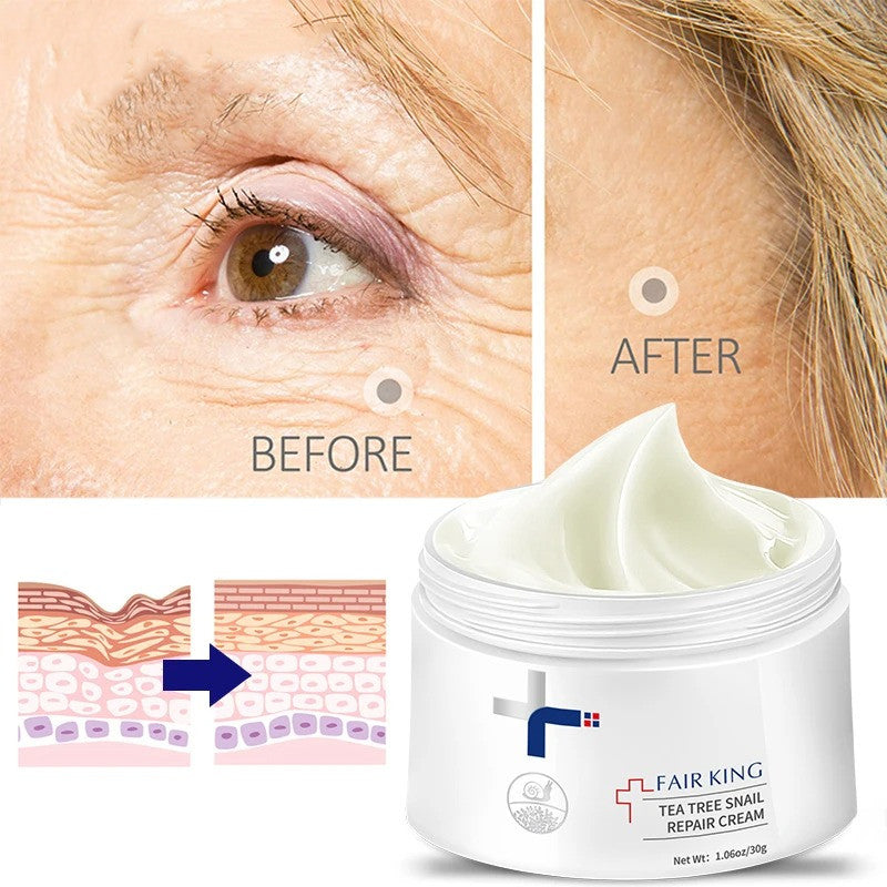 Hydrating Tea Tree Snail Recovery Cream for Face - 35ml