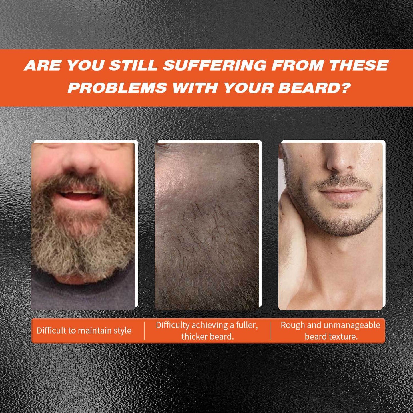 Beard Microneedle Roller & 30ml Beard Serum Set - Facial Grooming