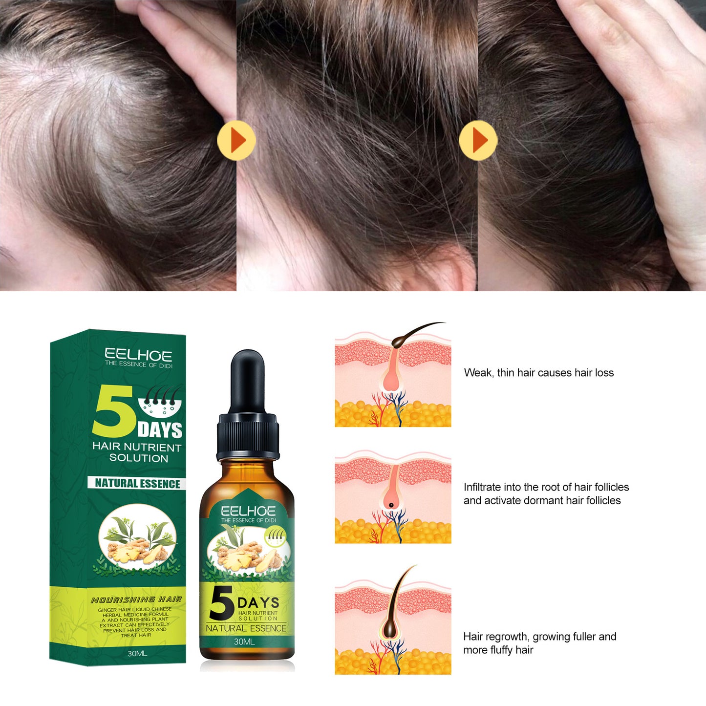 Ginger Hair Growth Essential Oil with Ginseng Extract for Hair Care