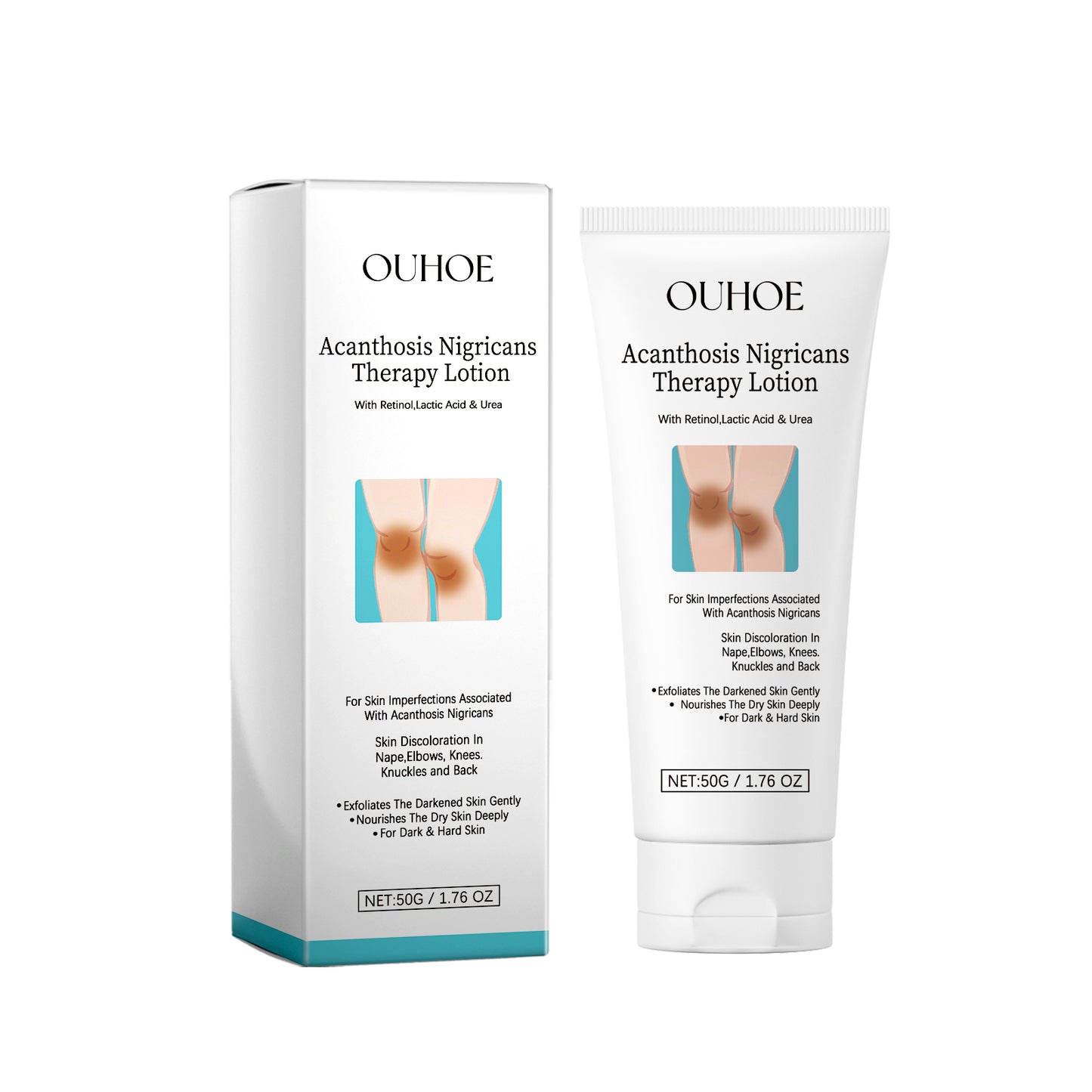 Acanthosis Nigricans Therapy Lotion - Dark Spot Corrector for Skin Repair