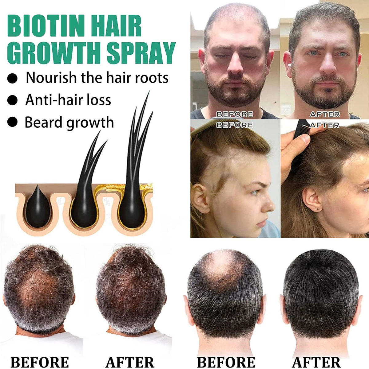 Anti Hair Loss Serum Essence Liquid 20ml
