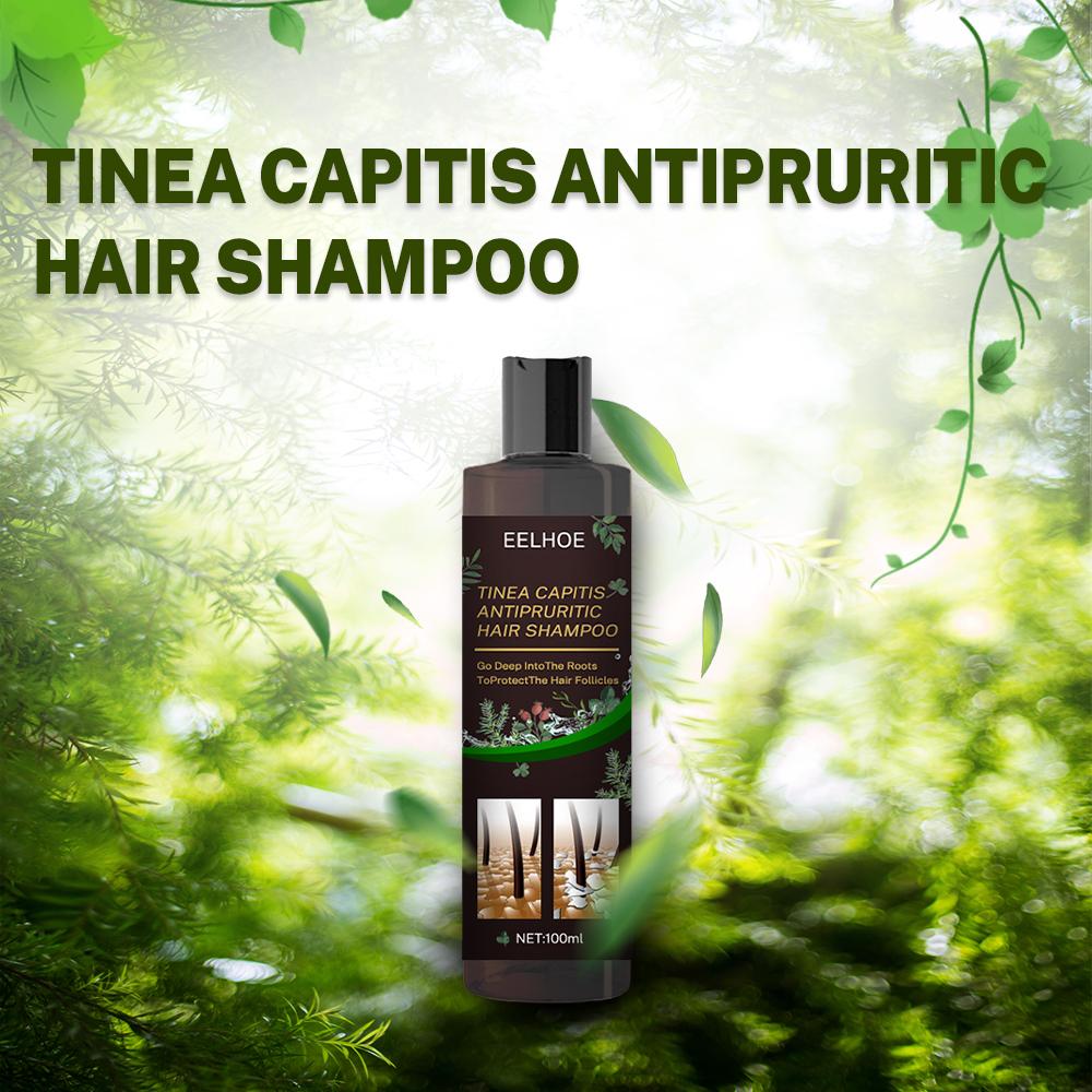 Anti-Dandruff Shampoo for Scalp Itch Relief and Hair Loss Prevention