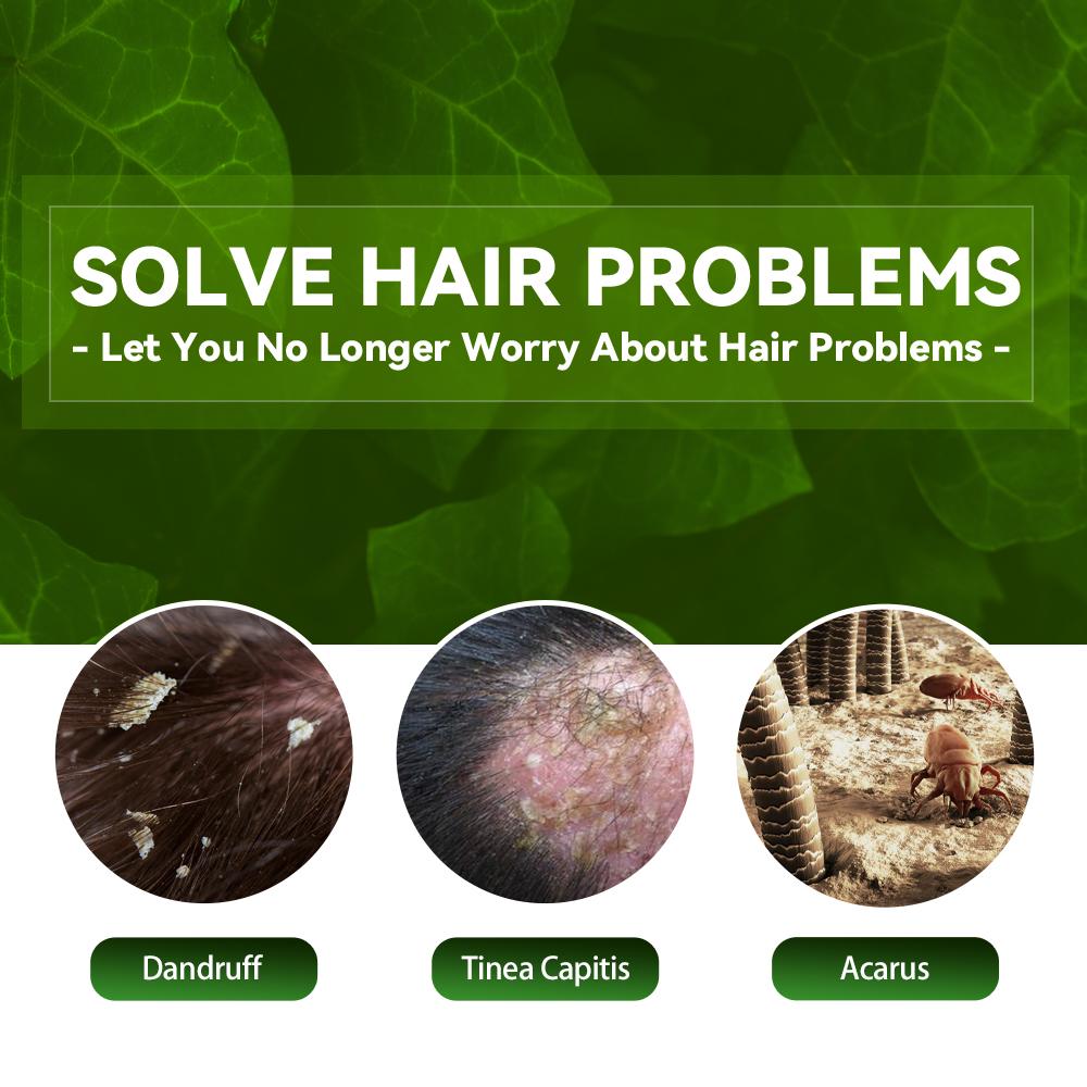 Anti-Dandruff Shampoo for Scalp Itch Relief and Hair Loss Prevention