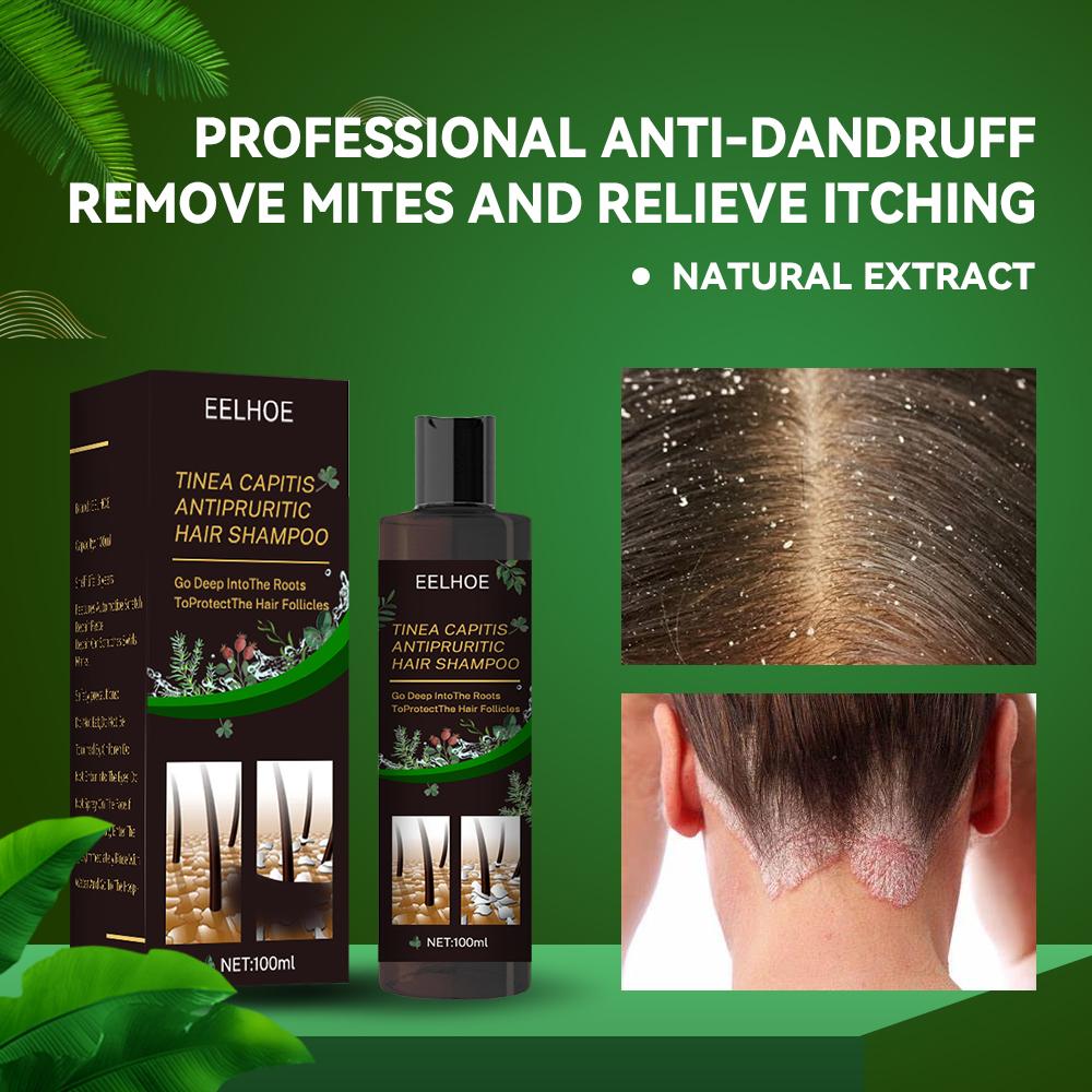 Anti-Dandruff Shampoo for Scalp Itch Relief and Hair Loss Prevention
