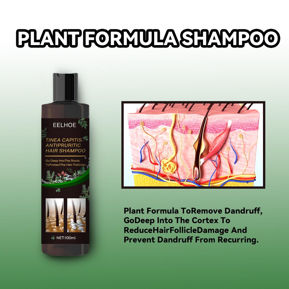 Anti-Dandruff Shampoo for Scalp Itch Relief and Hair Loss Prevention