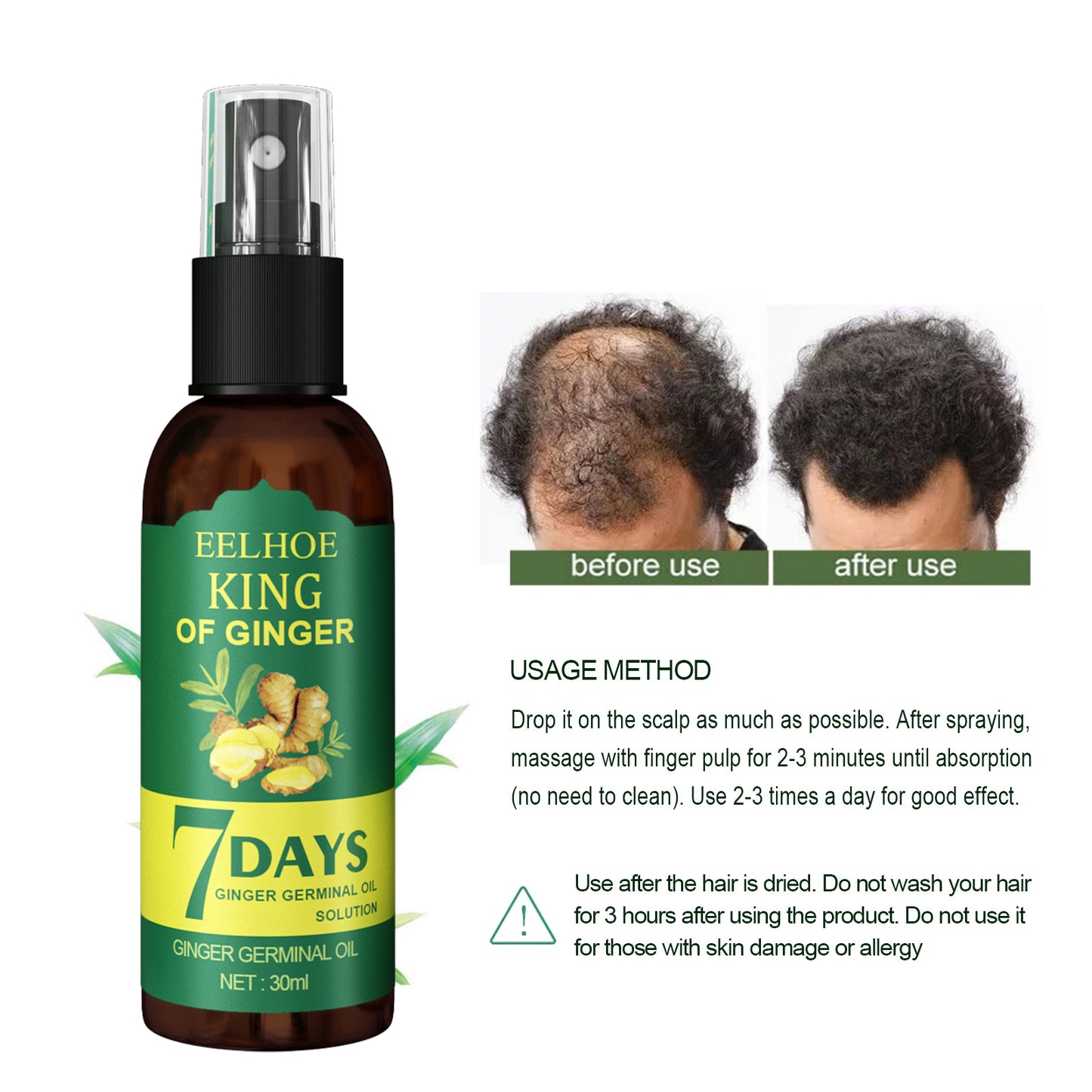 Ginger Scalp Nourishing Hair Spray - Hair Growth and Strengthening Treatment