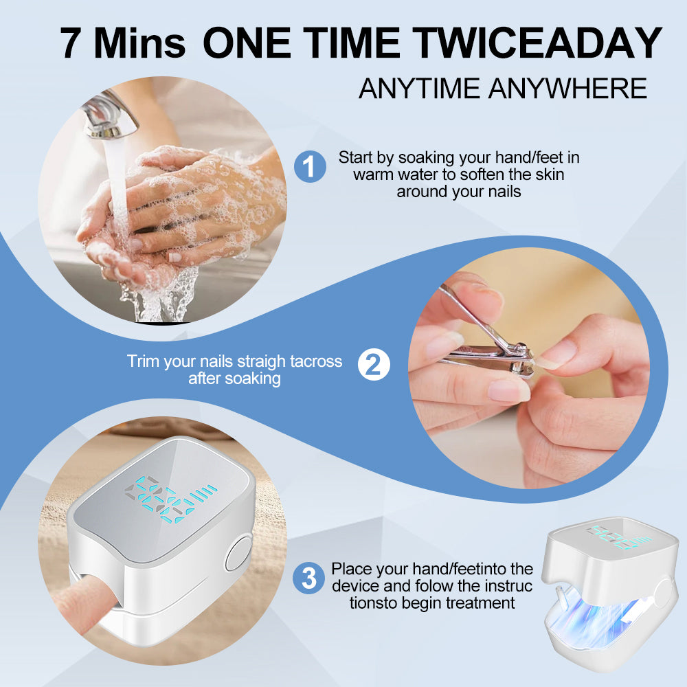 LED Nail Treatment Device for Discolored & Thickened Nails - White