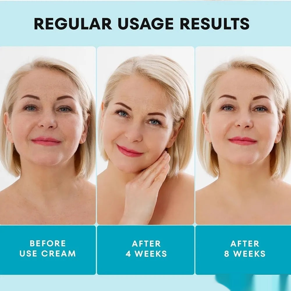 Hydrating Collagen Face Cream for Acne & Skin Brightening 50ml