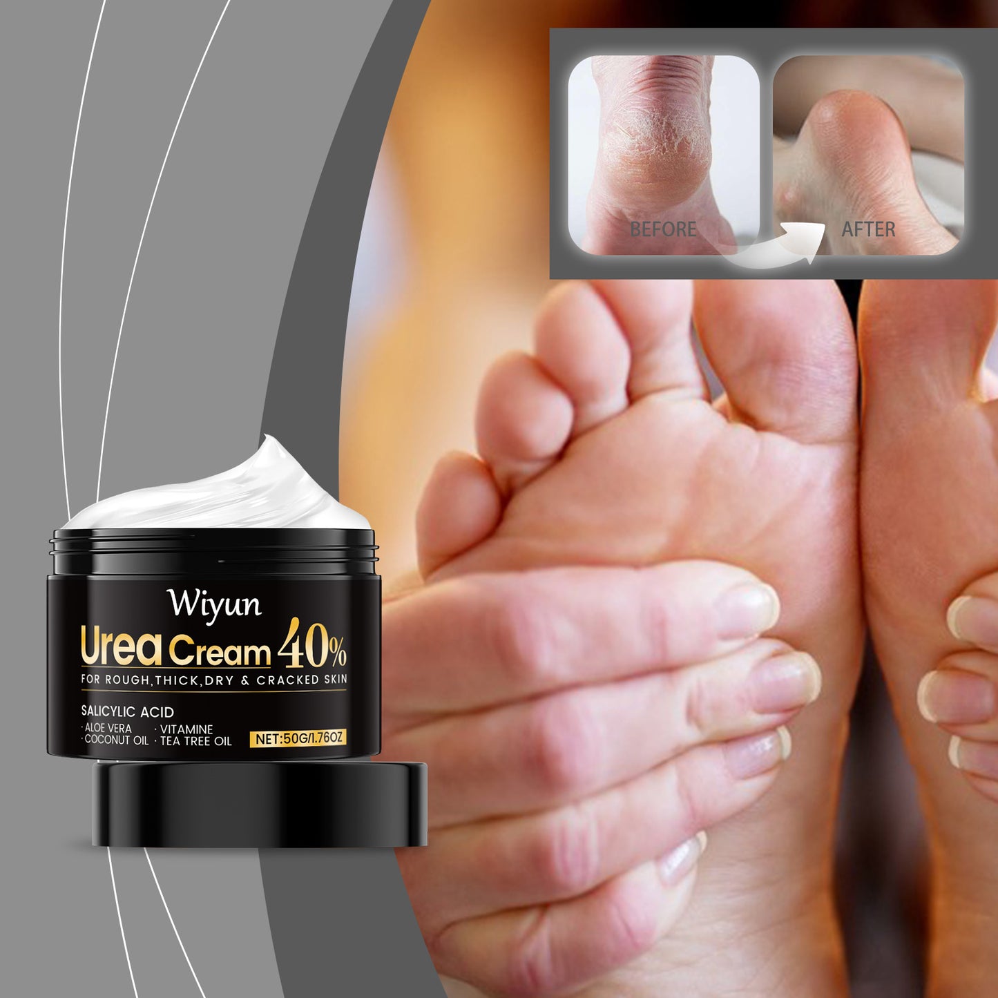 Hand and Foot Care Urea Cream - Moisturizing Skin Treatment 50g